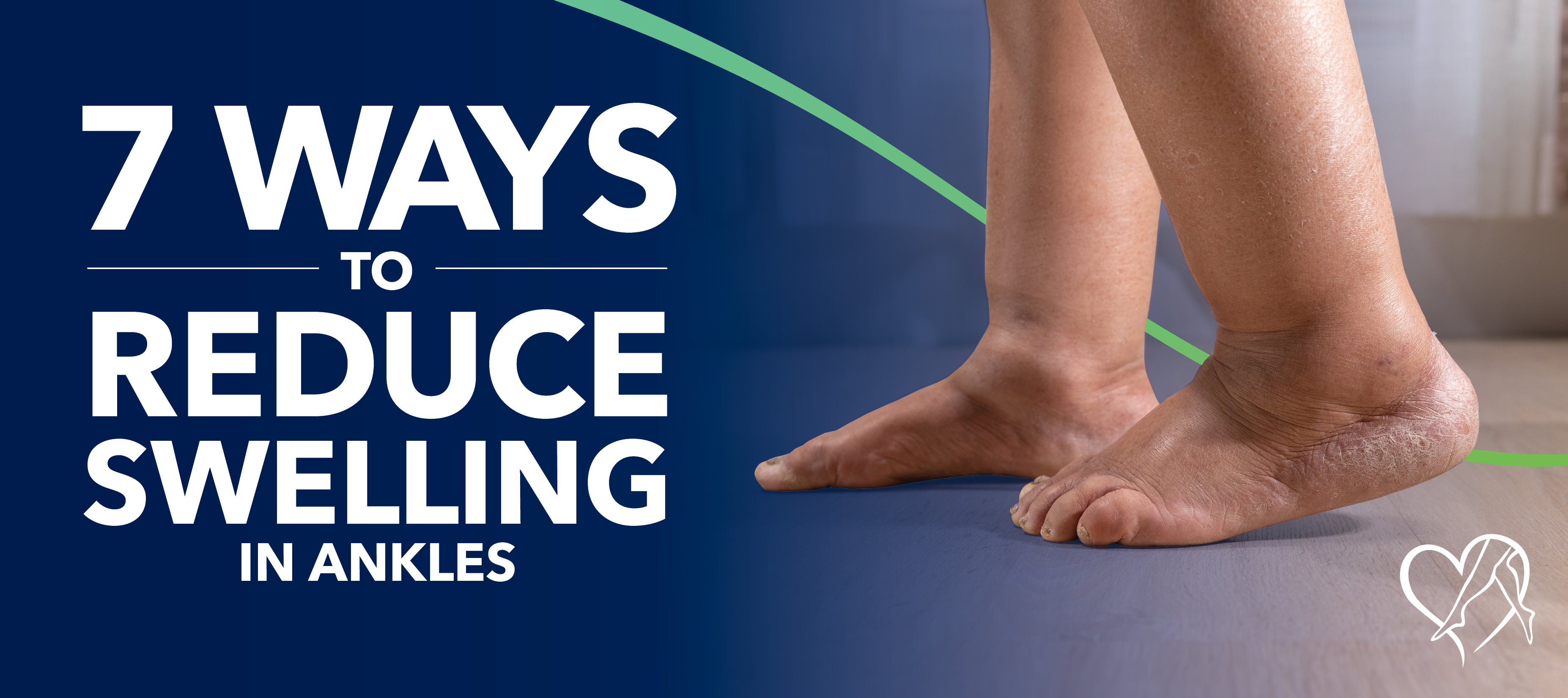 Blog Image 7 Ways To Reduce Swelling In Ankles