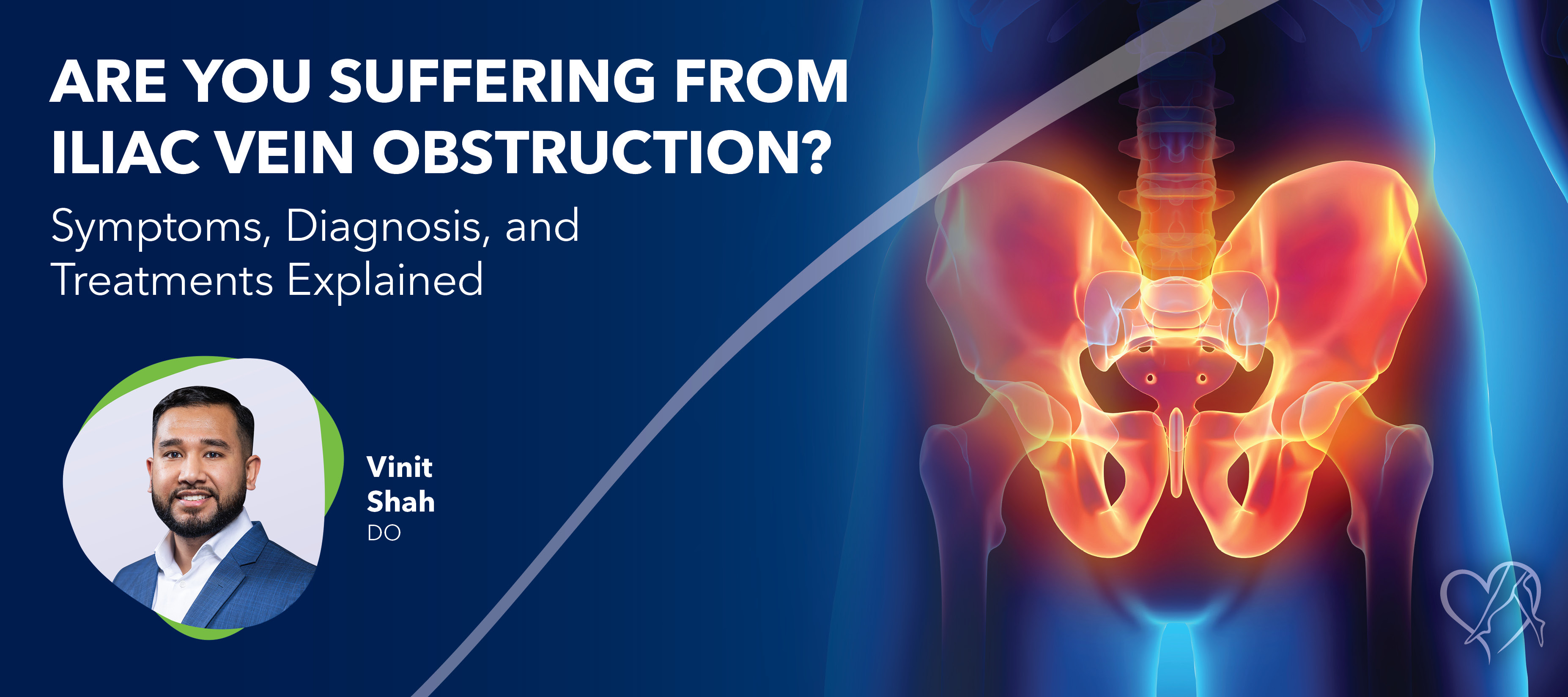 Blog Image Are You Sufferingfrom Iliac Vein Obstruction