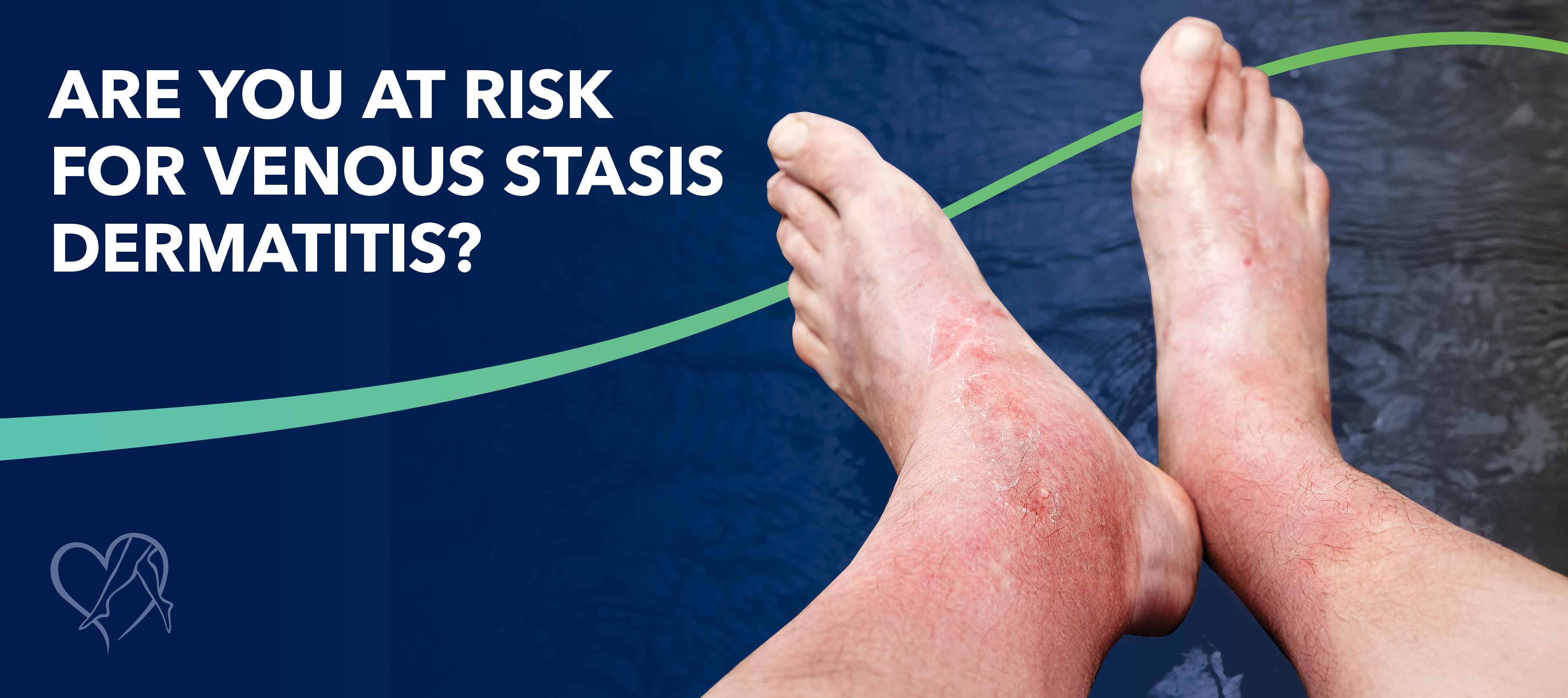 Blog Image Are Youat Riskfor Venous Stasis Dermatitis