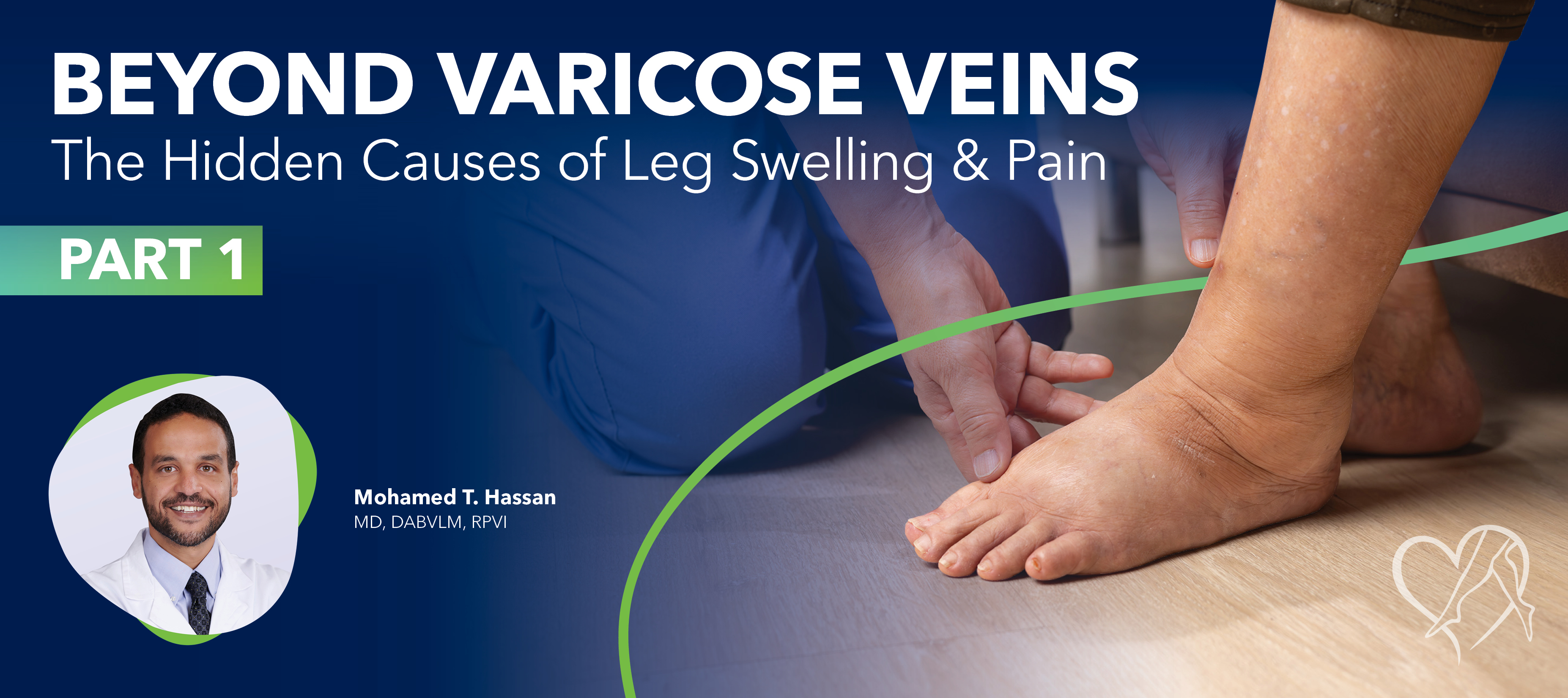 Blog Image Beyond Varicose Veins