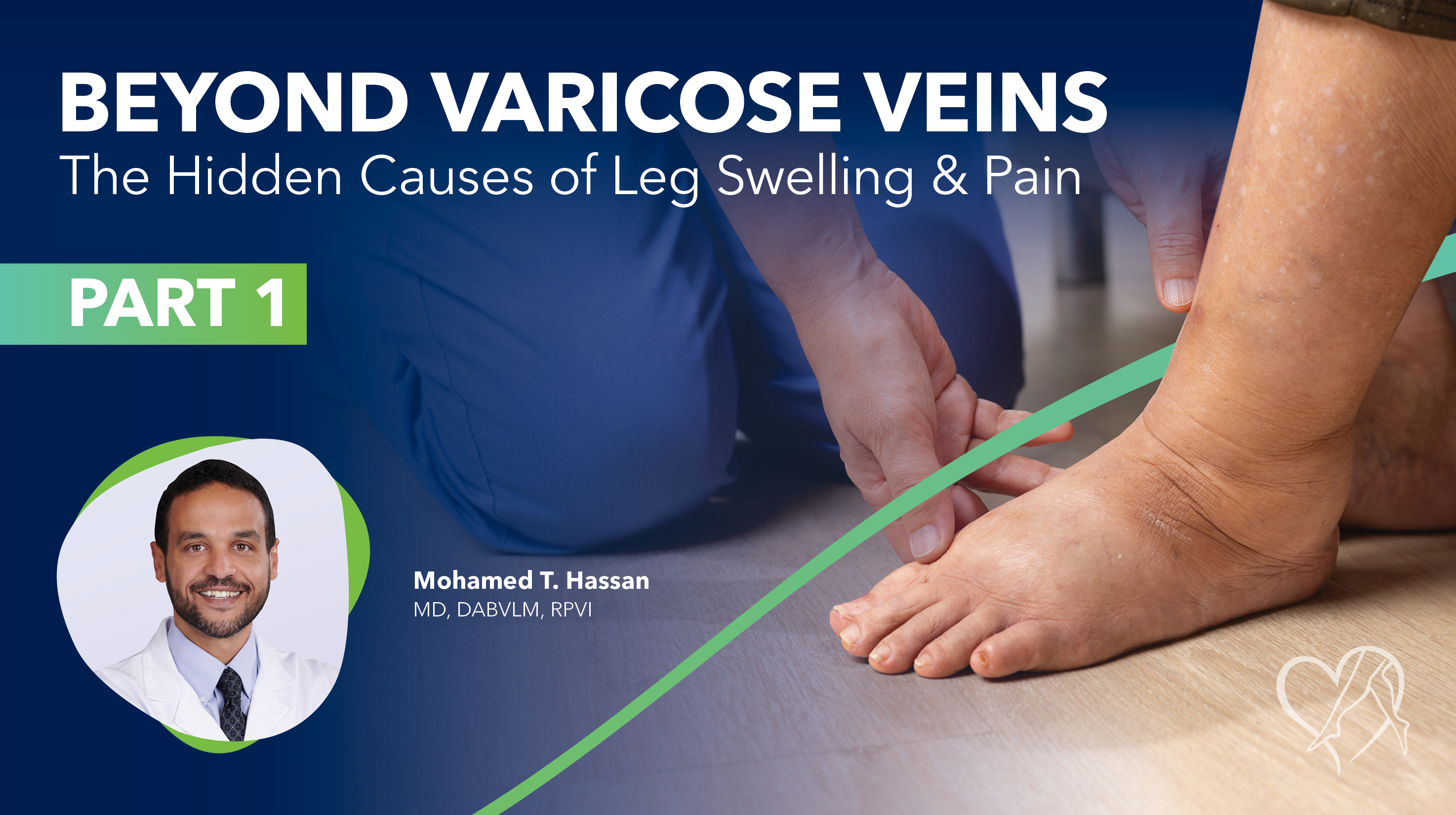 Blog Image Beyond Varicose Veins Thumbnail