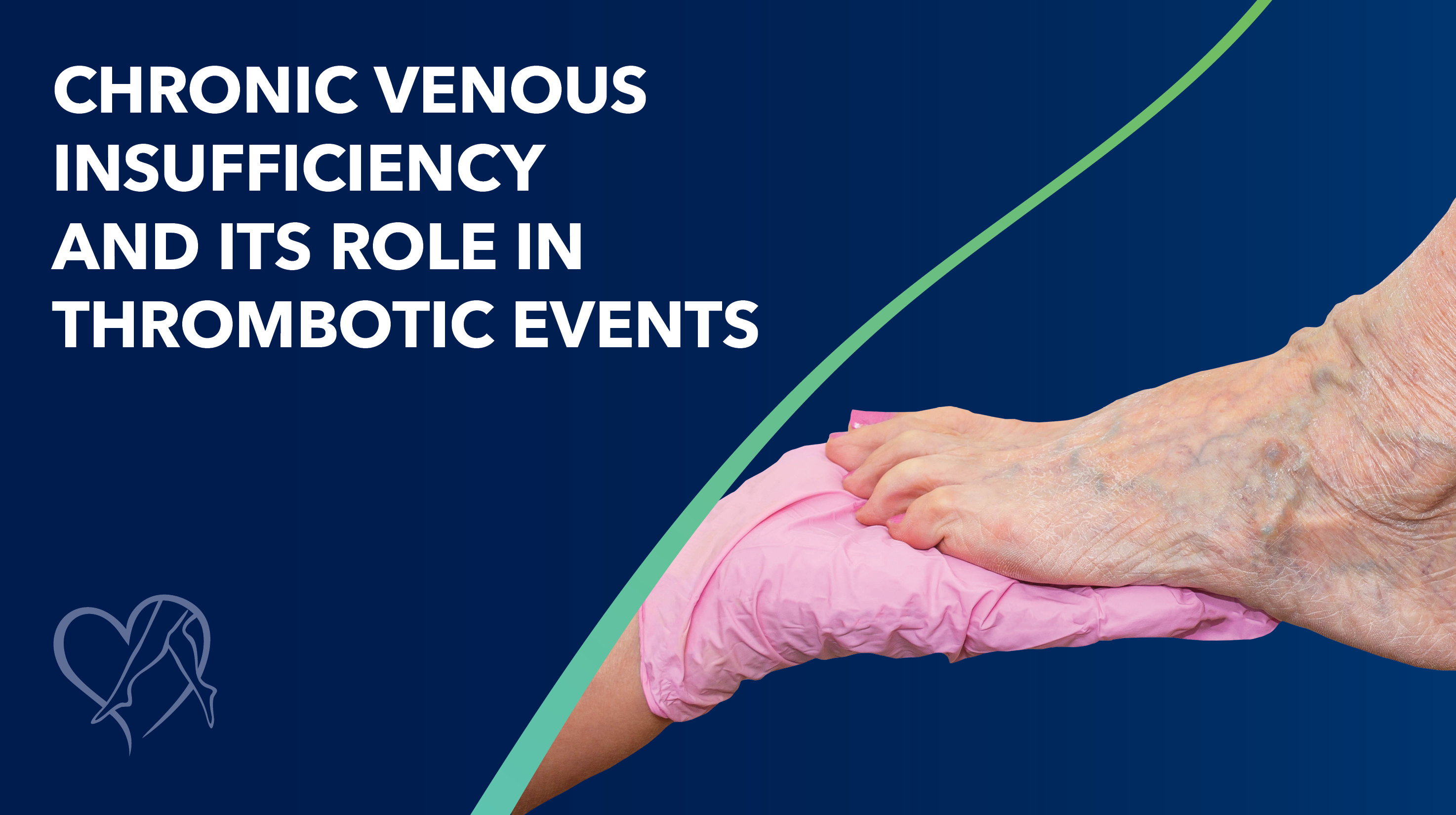 Blog Image CVI Thrombotic Events Thumbnail