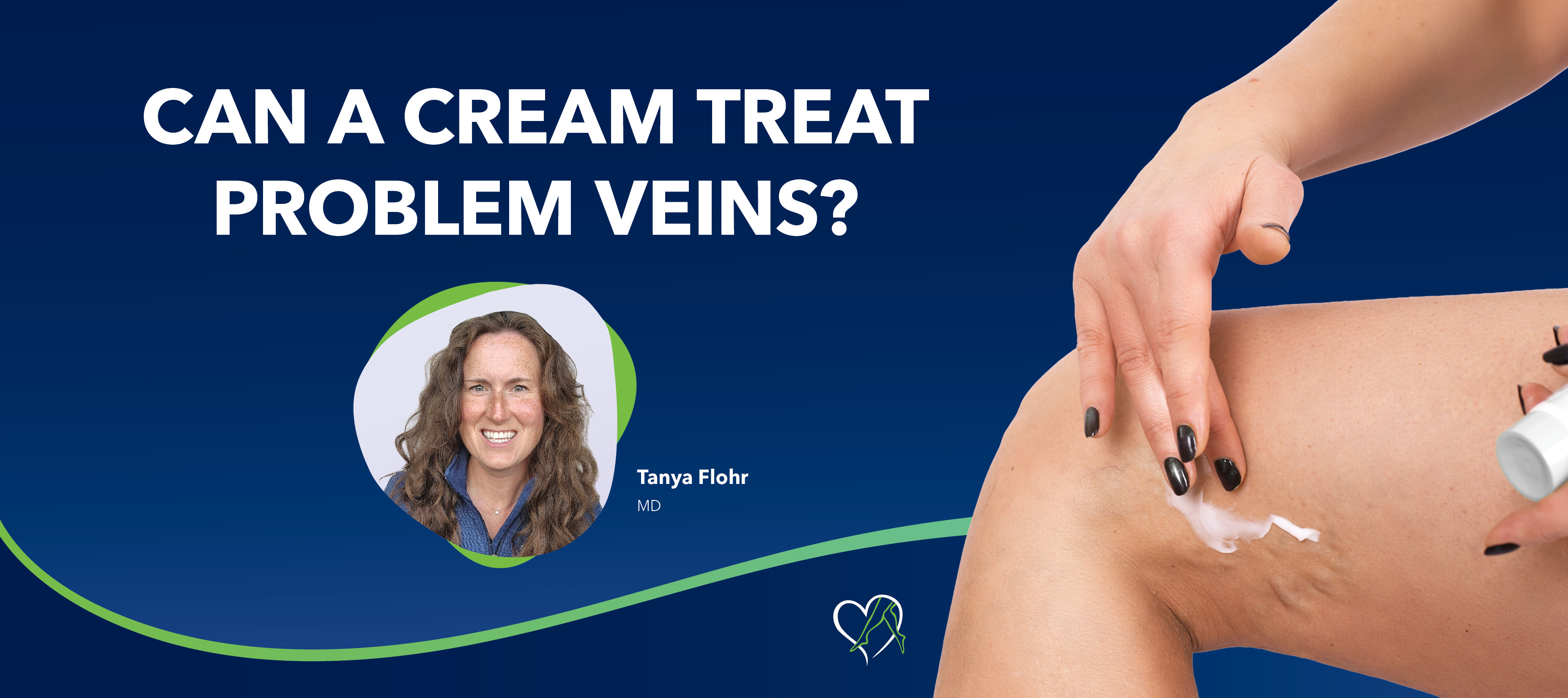Blog Image Can A Cream Treat Problem Veins