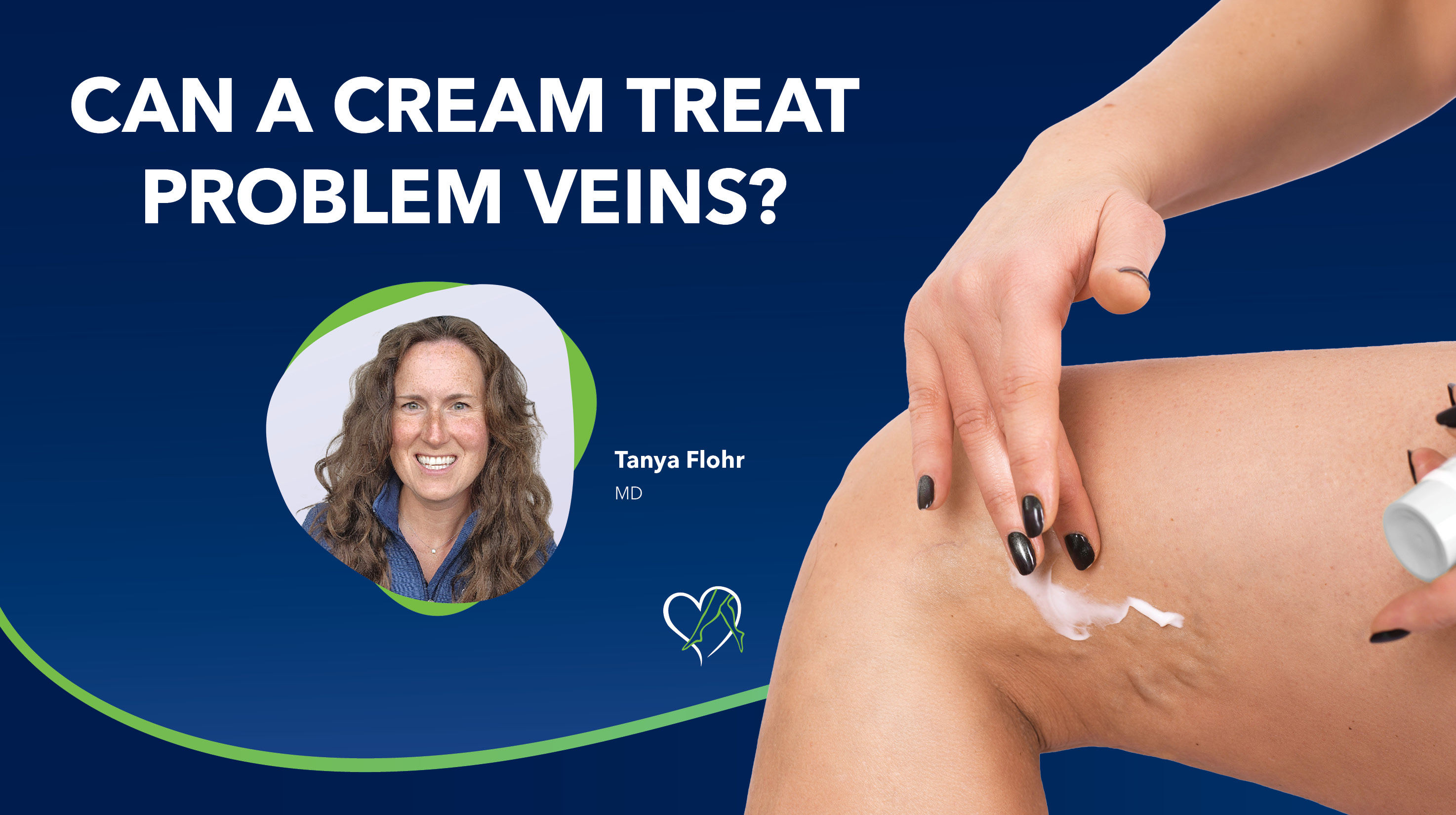 Blog Image Can A Cream Treat Problem Veins Thumbnail