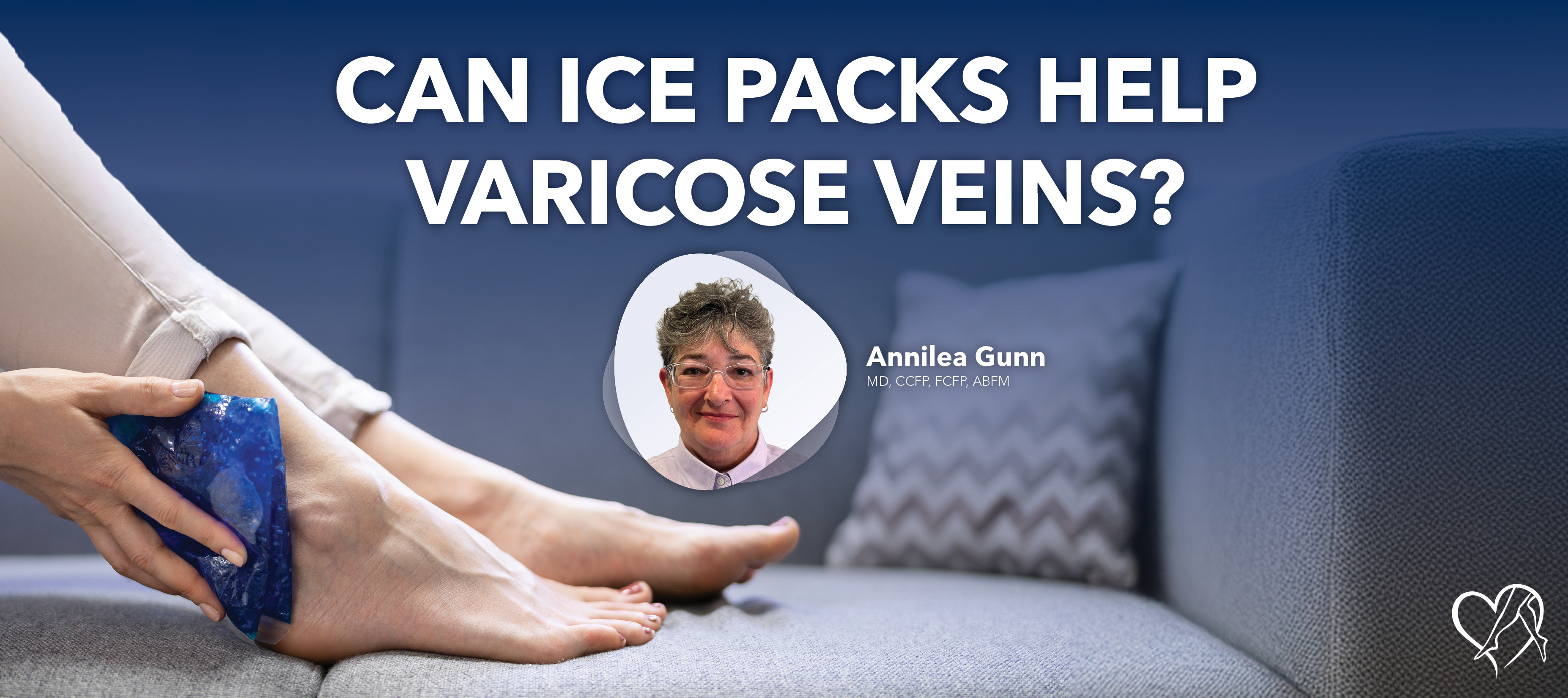 Blog Image Can Ice Packs Help Varicose Veins 2026 2