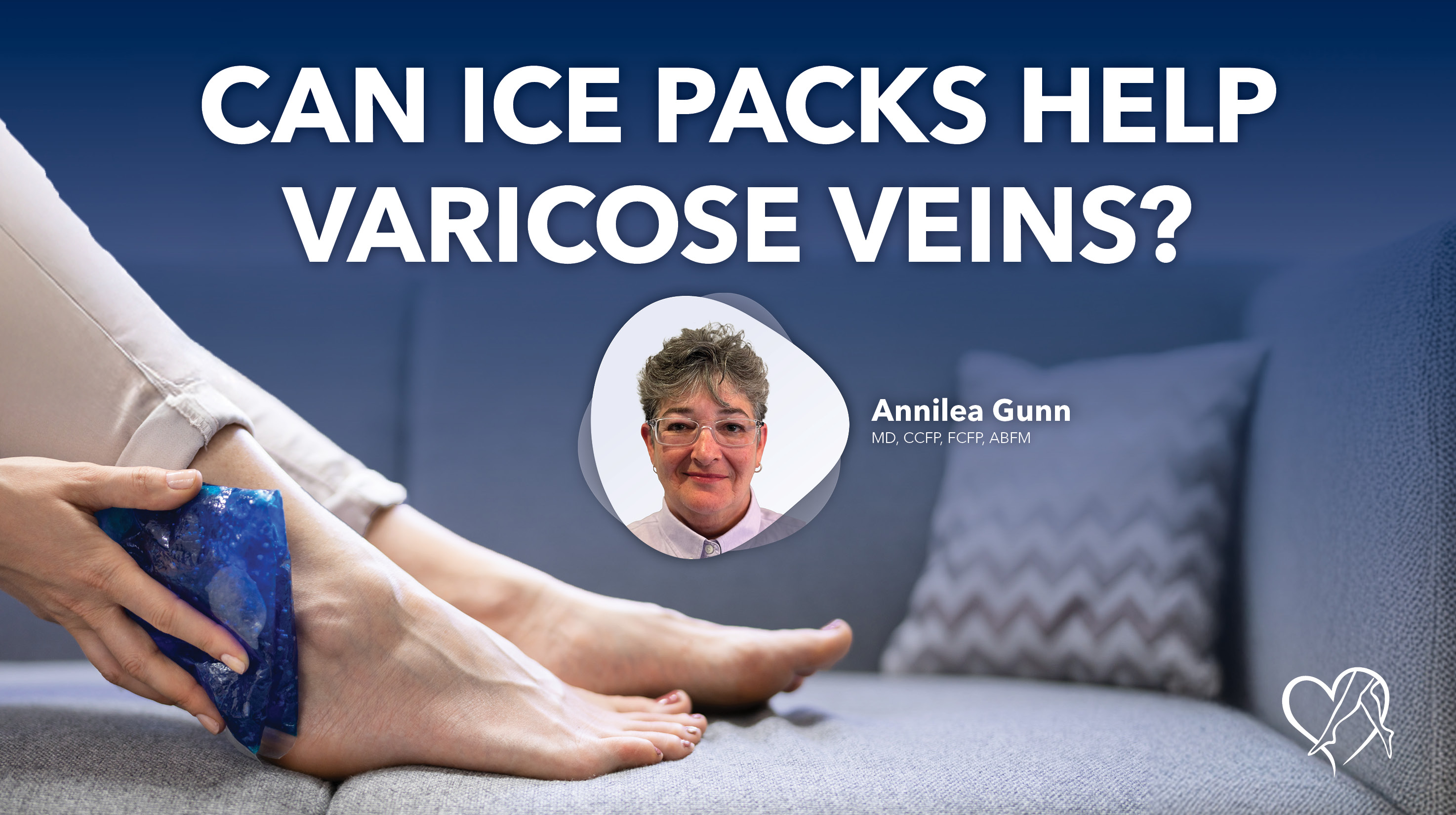 Blog Image Can Ice Packs Help Varicose Veins 2026 Thumbnail 1