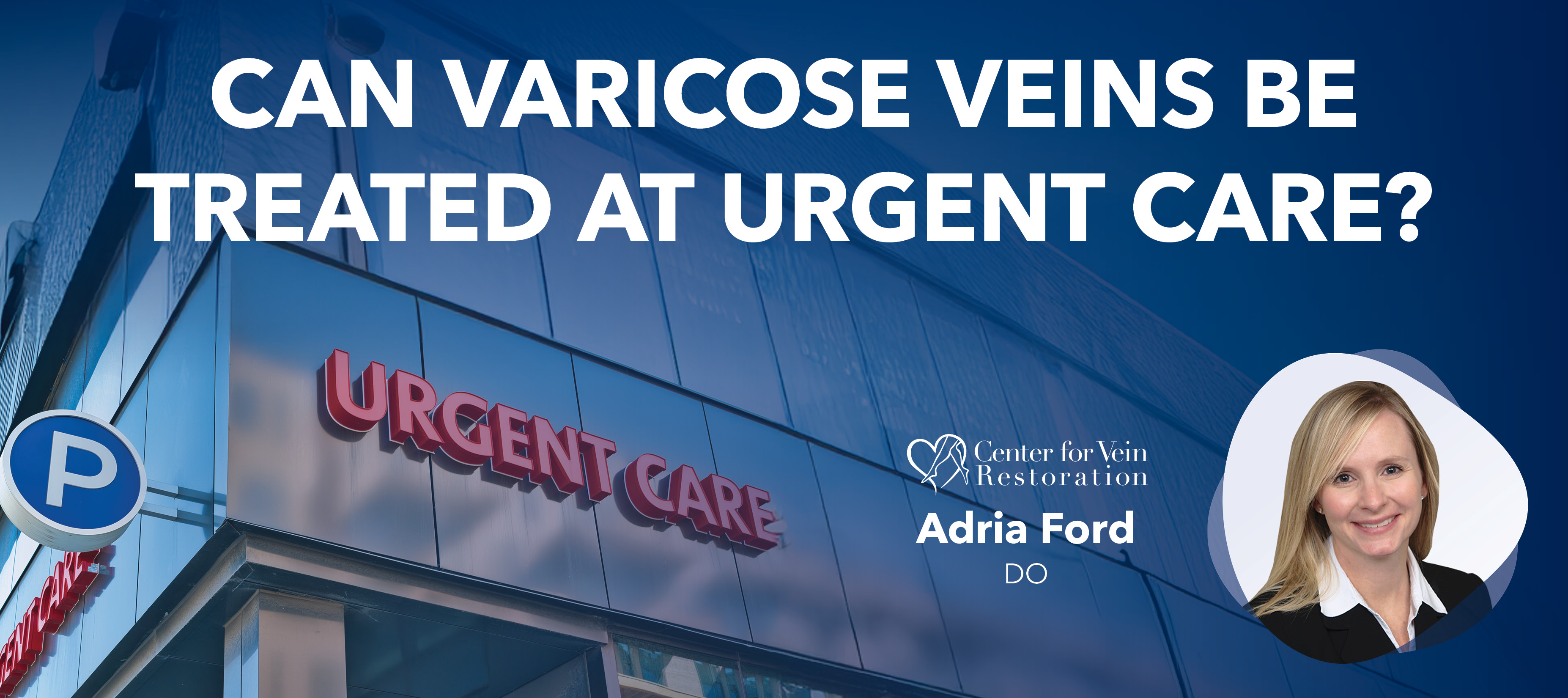 Blog Image Can Varicose Veins Be Treated At Urgent Care