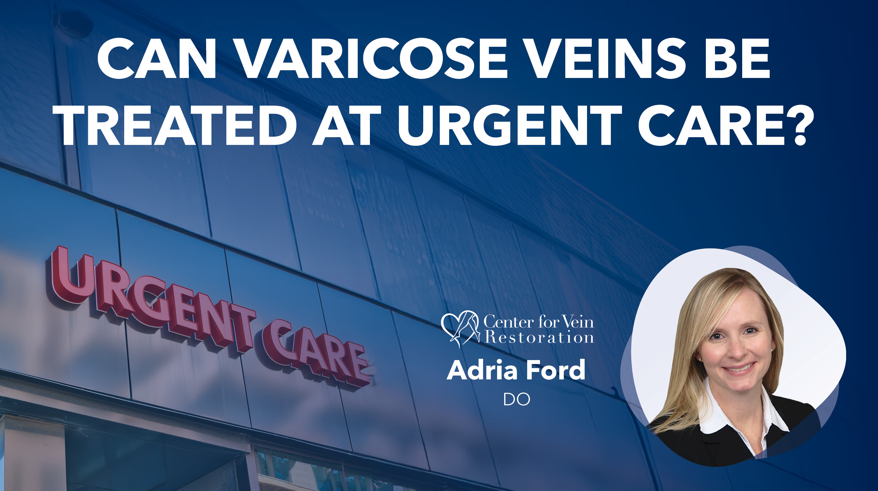 Blog Image Can Varicose Veins Be Treated At Urgent Care Thumbnail