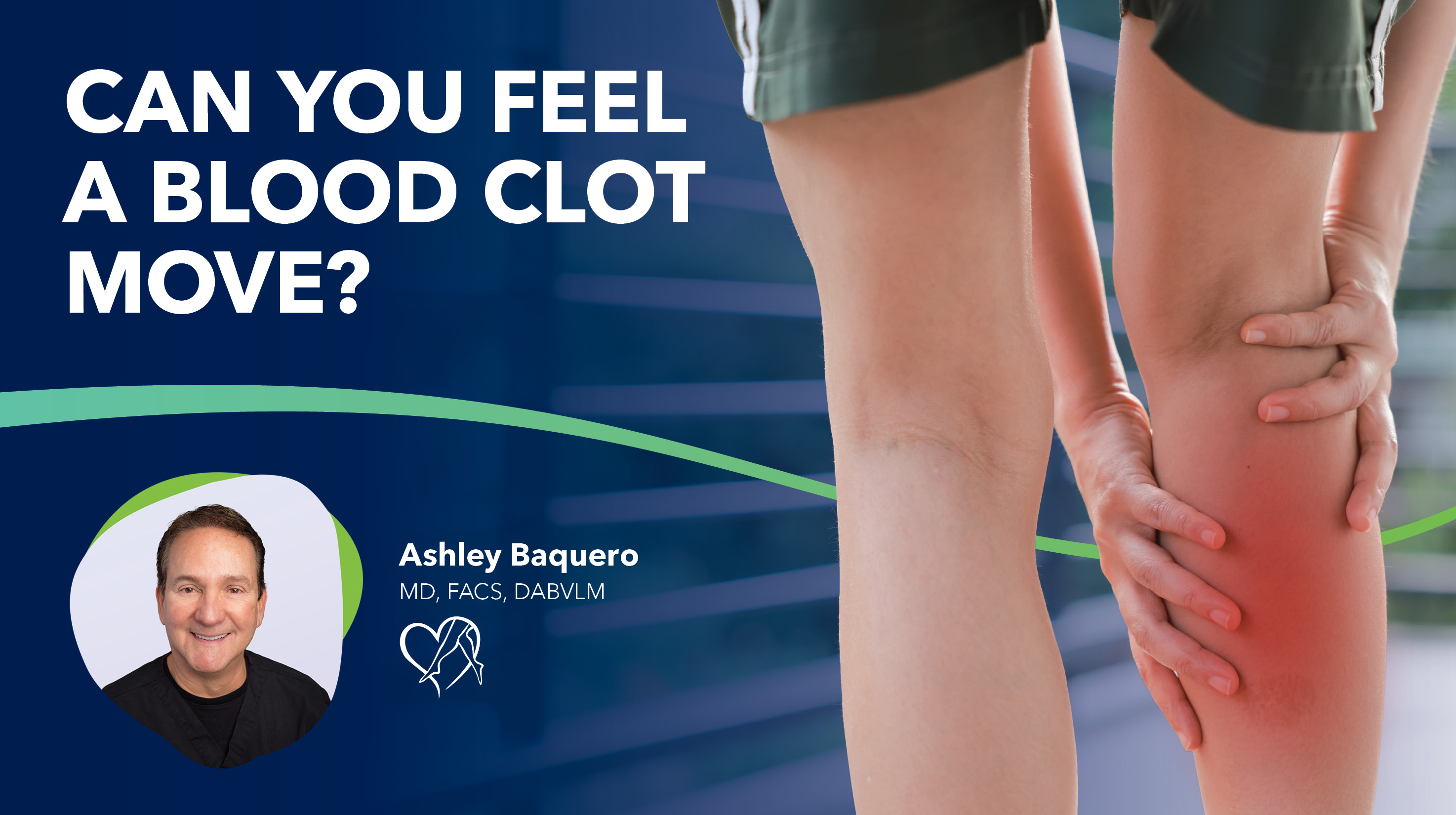 Blog Image Can You Feel A Blood Clot Move 2026 Thumbnail