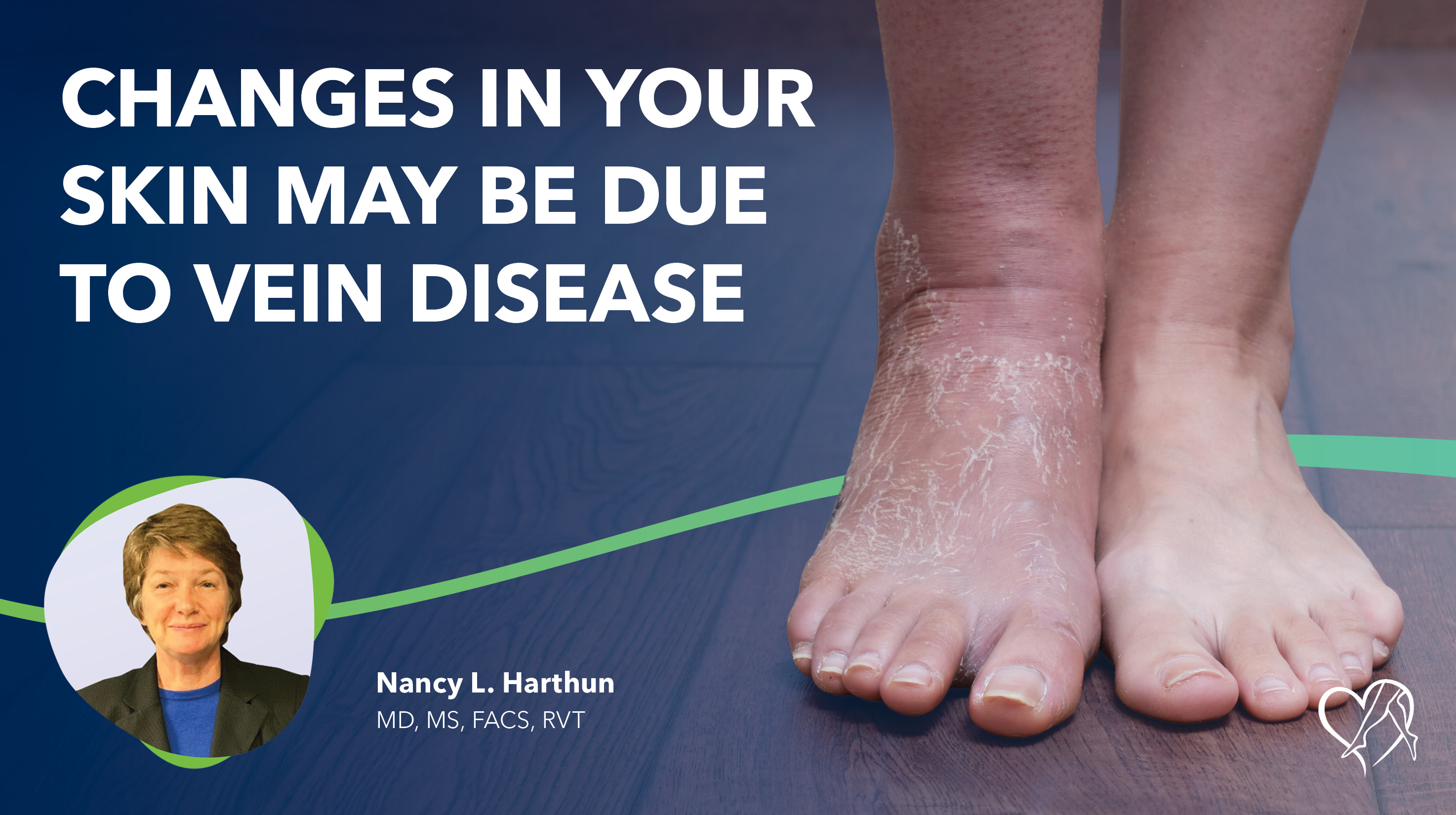 Blog Image Changes in Your Skin May be Due to Vein Disease Thumbnail