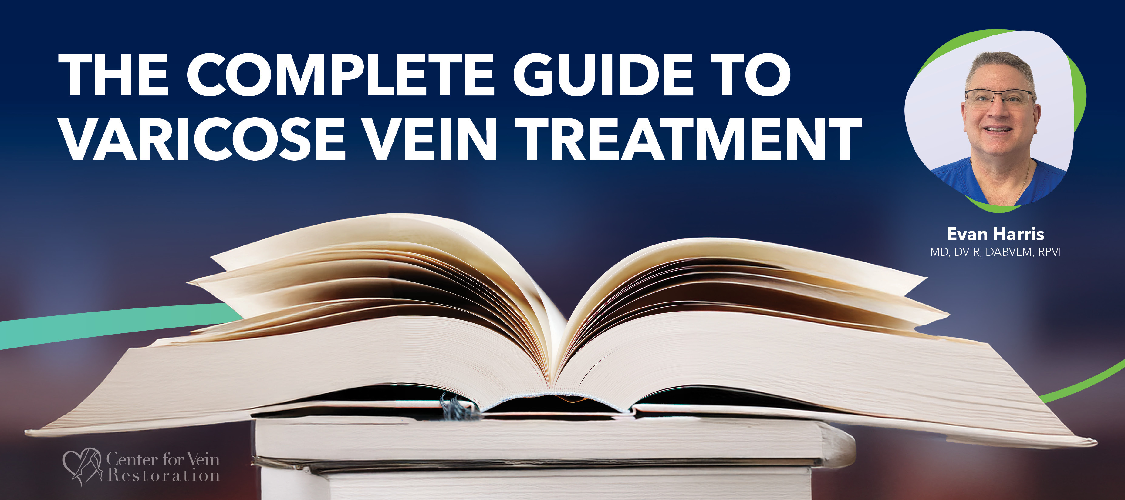 Blog Image Complete Guide To Varicose Vein Treatment
