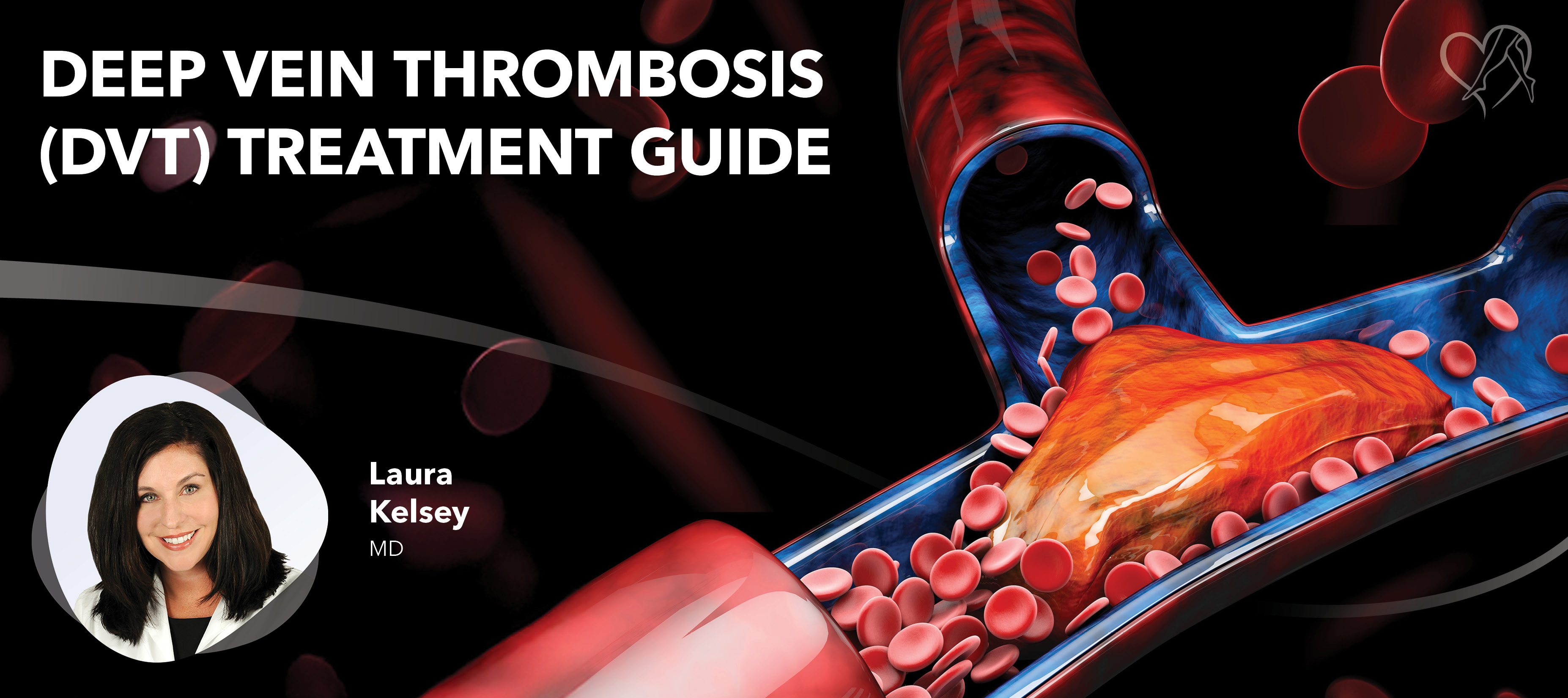 Blog Image DVT Treatment Guide Dr Kelsey