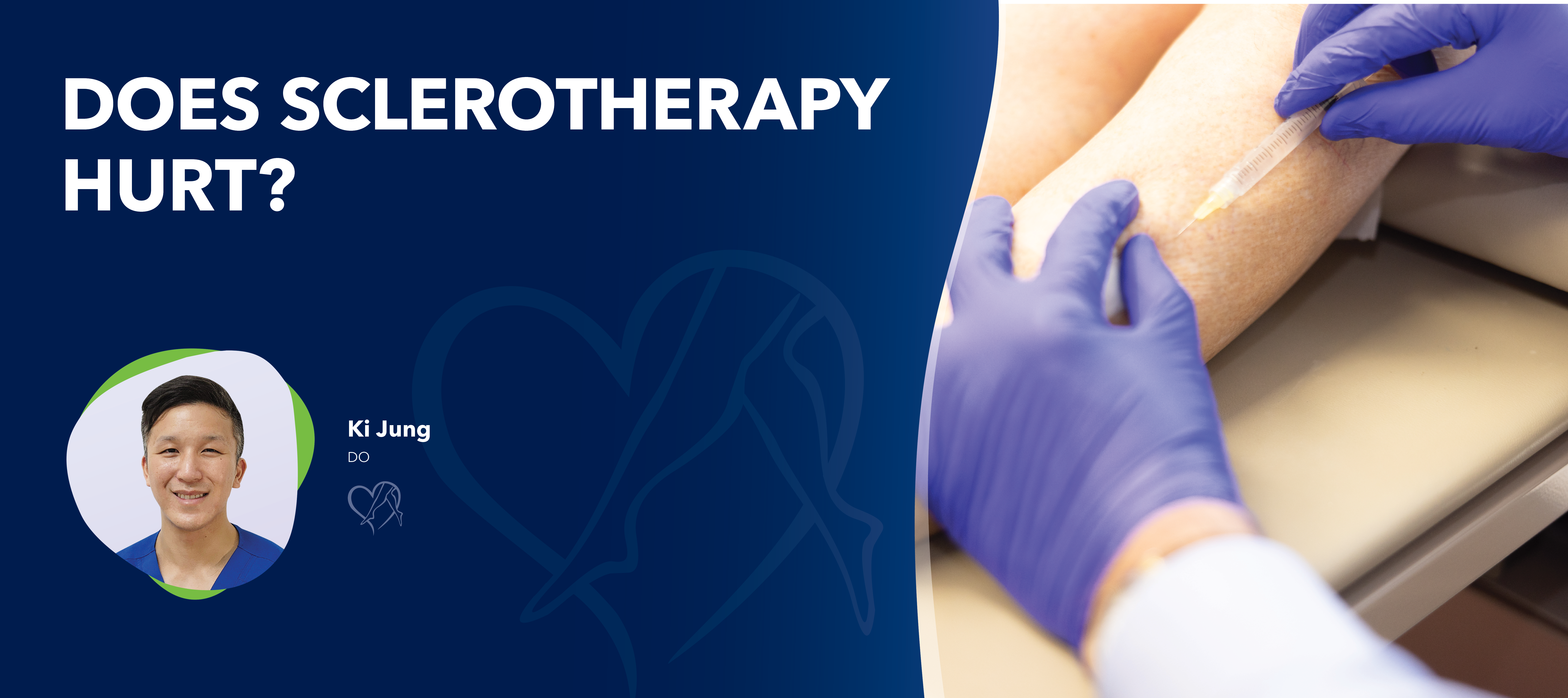 Blog Image Does Sclerotherapy Hurt 1