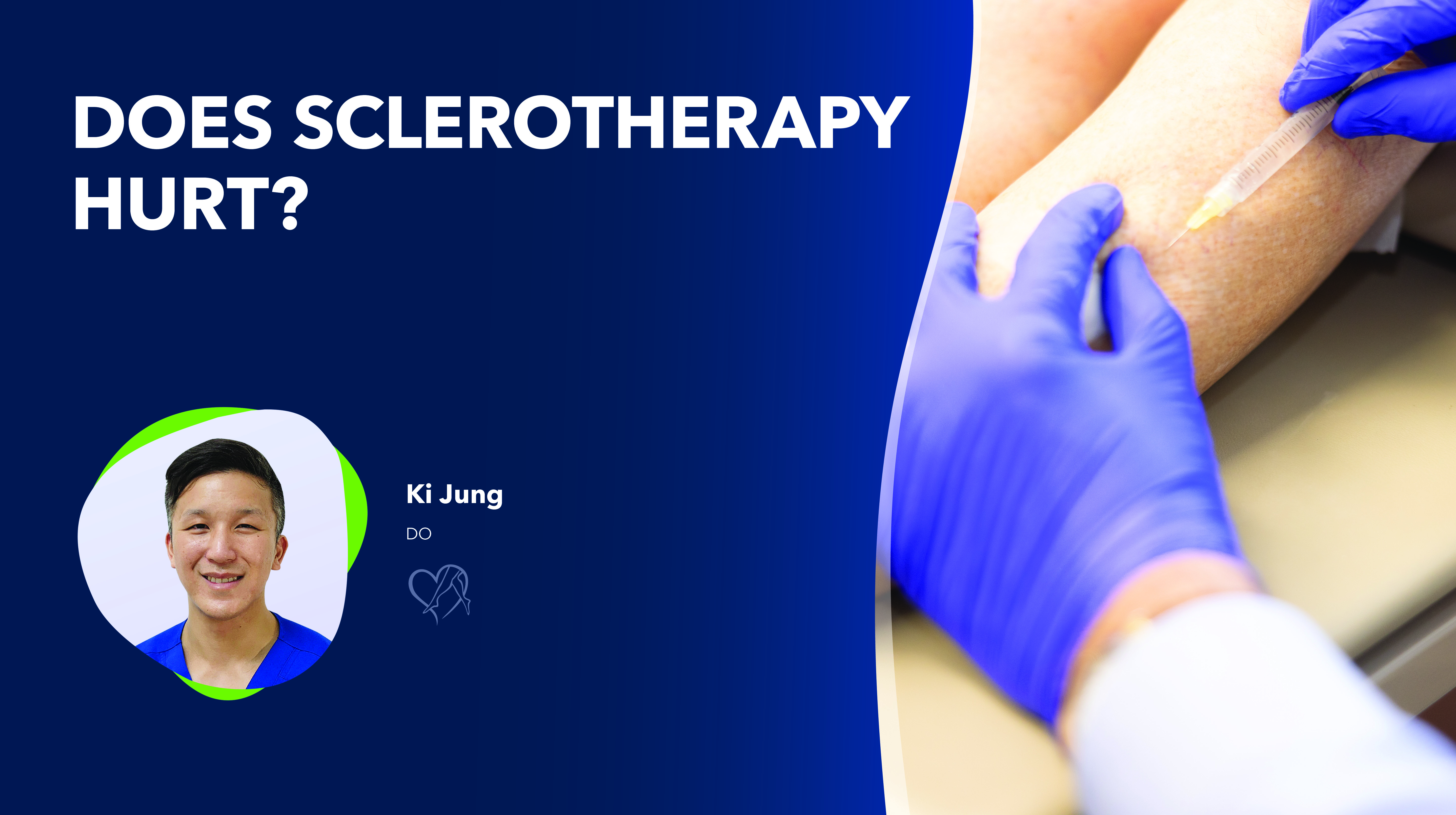 Blog Image Does Sclerotherapy Hurt Thumbnail