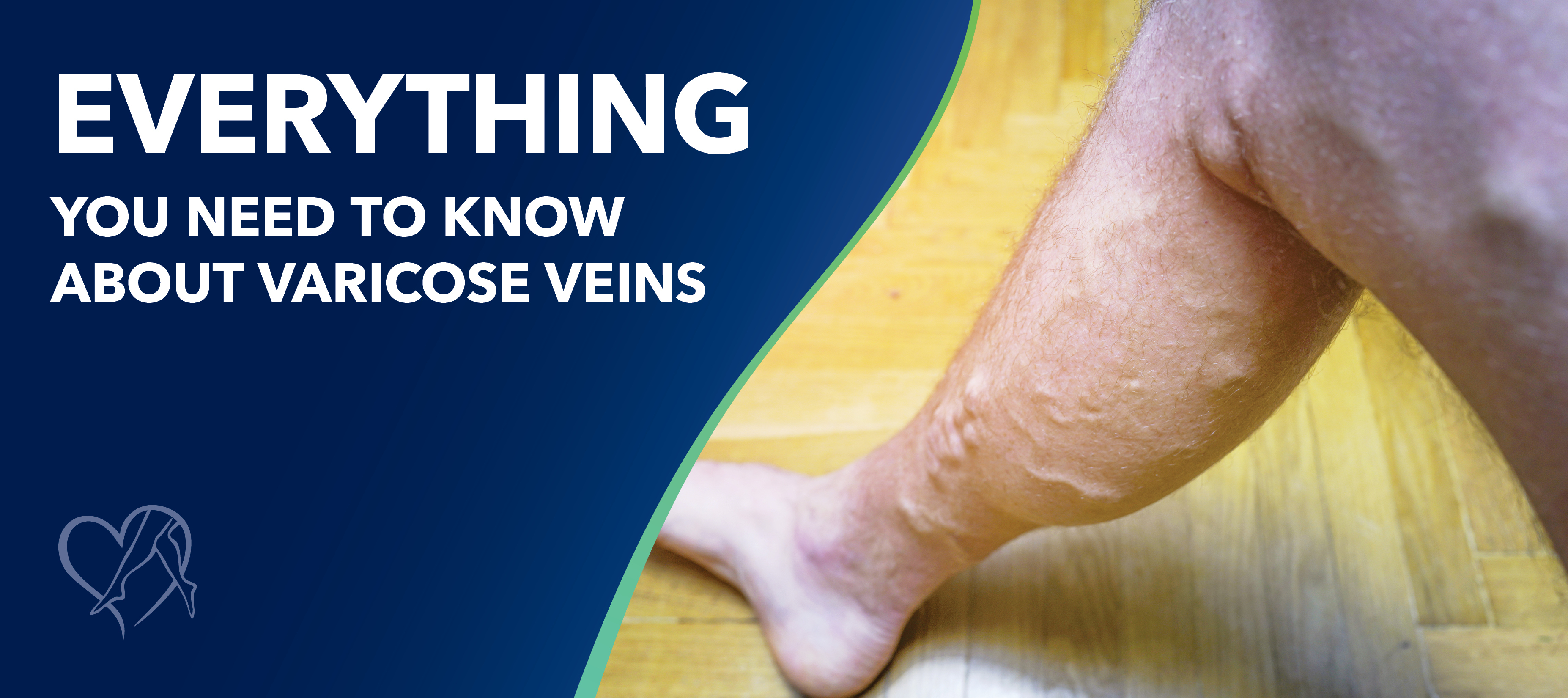 Blog Image Everything You Need To Know