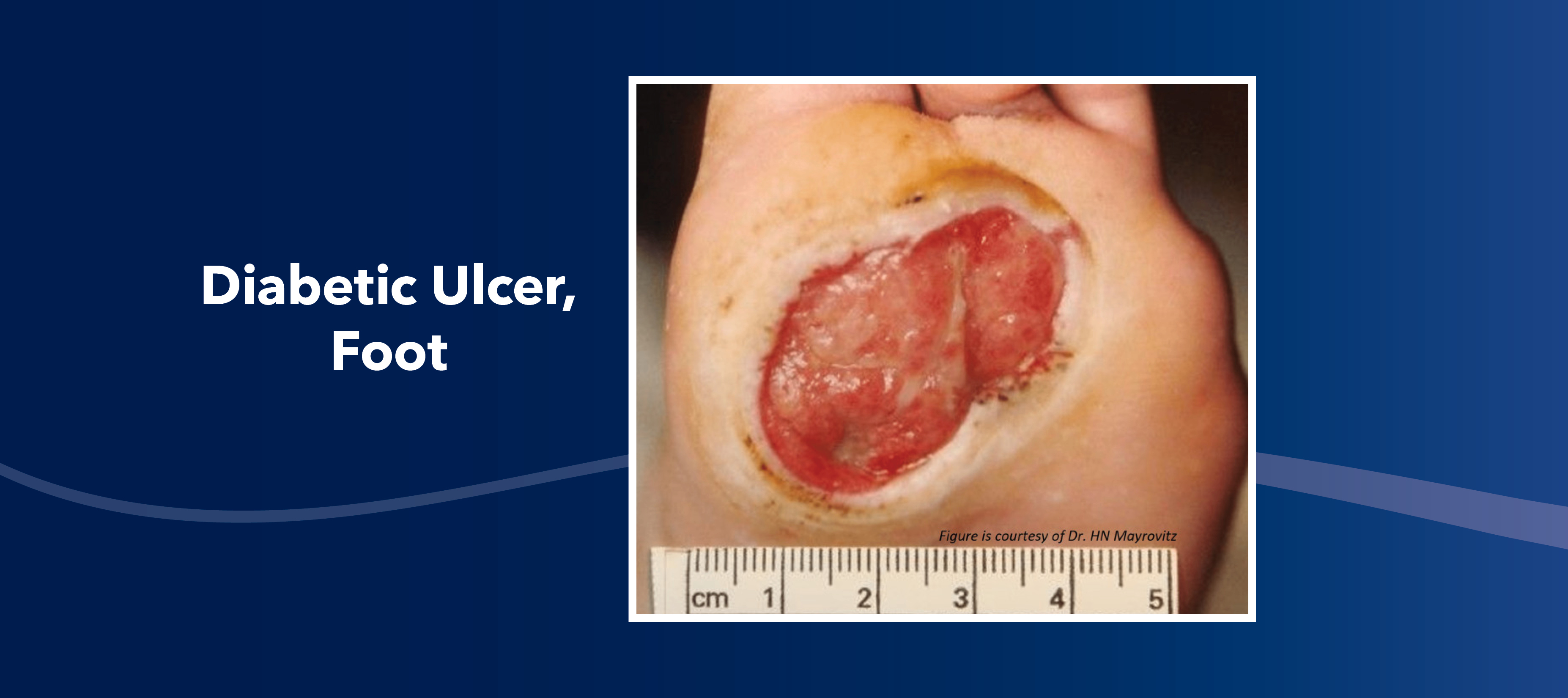 Blog Image How to Tell the Difference Between Types of Leg Wounds Blog Slider4