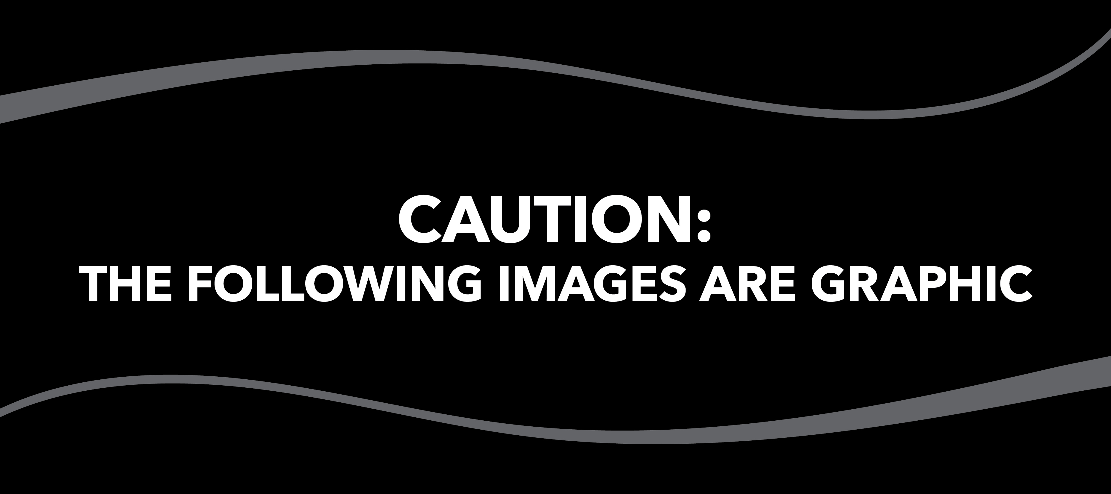 Blog Image How to Tell the Difference Between Types of Leg Wounds Blog Slider 1