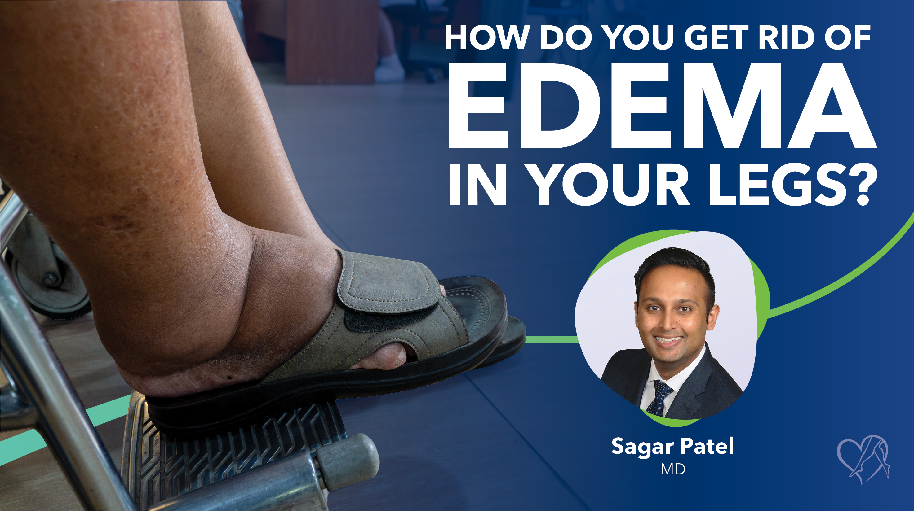 Blog Image How Do You Get Rid Of Edema In Your Legs Thumbnail