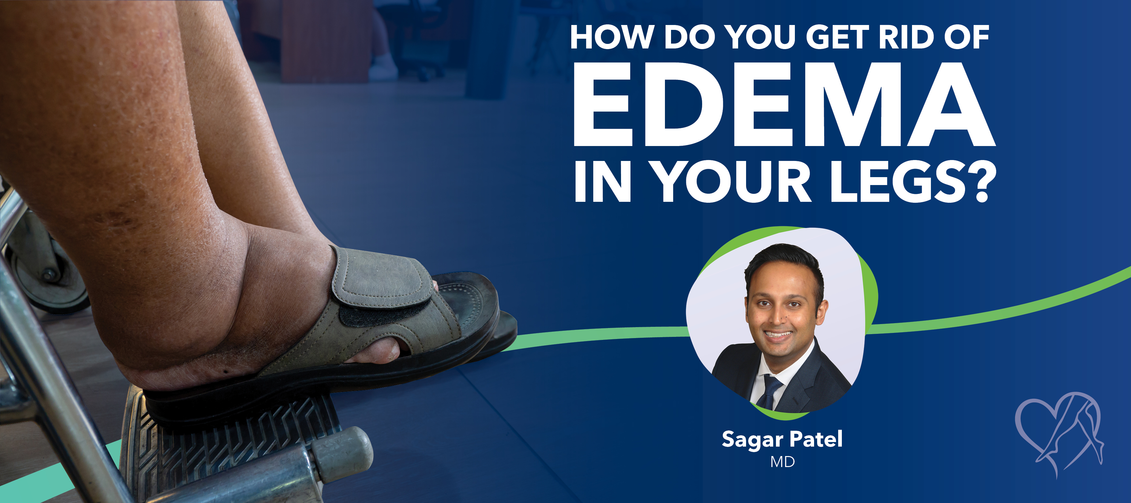 Blog Image How Do You Get Rid Of Edema In Your Legs