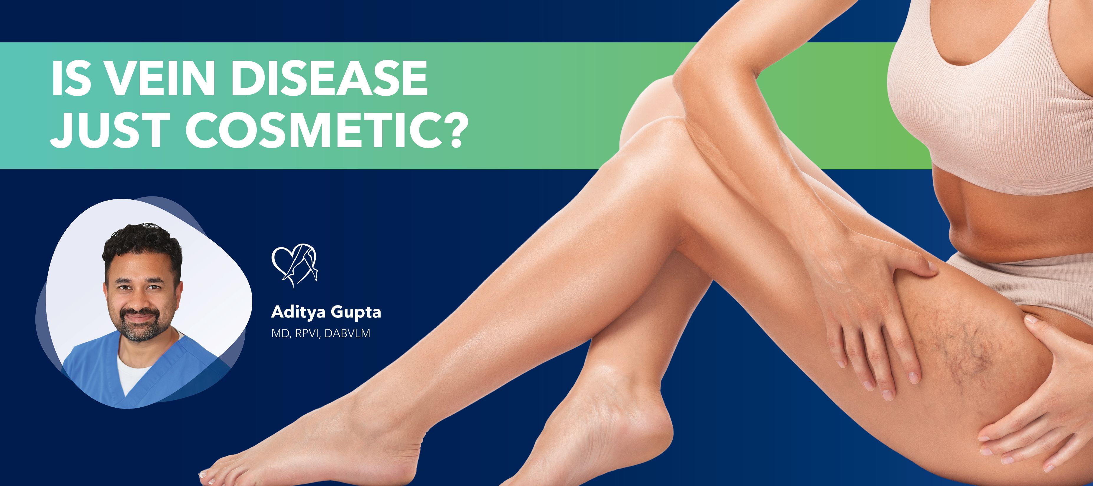 Blog Image Is Vein Disease Just Cosmetic