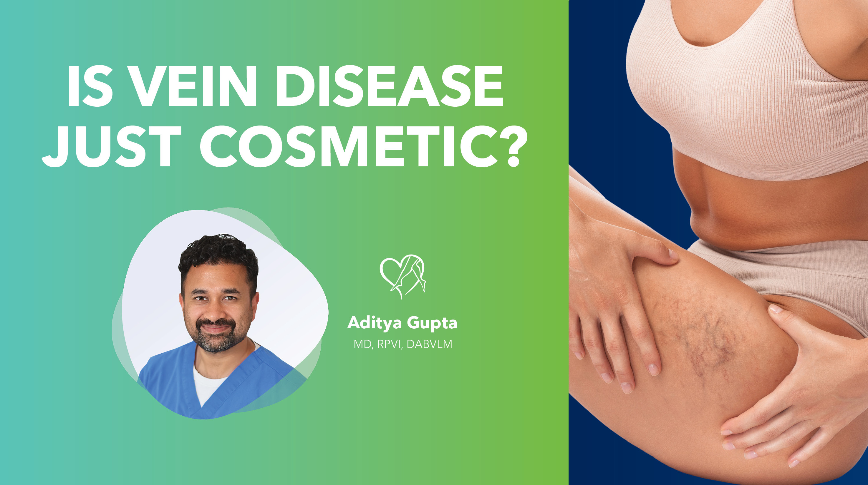 Blog Image Is Vein Disease Just Cosmetic Thumbnail