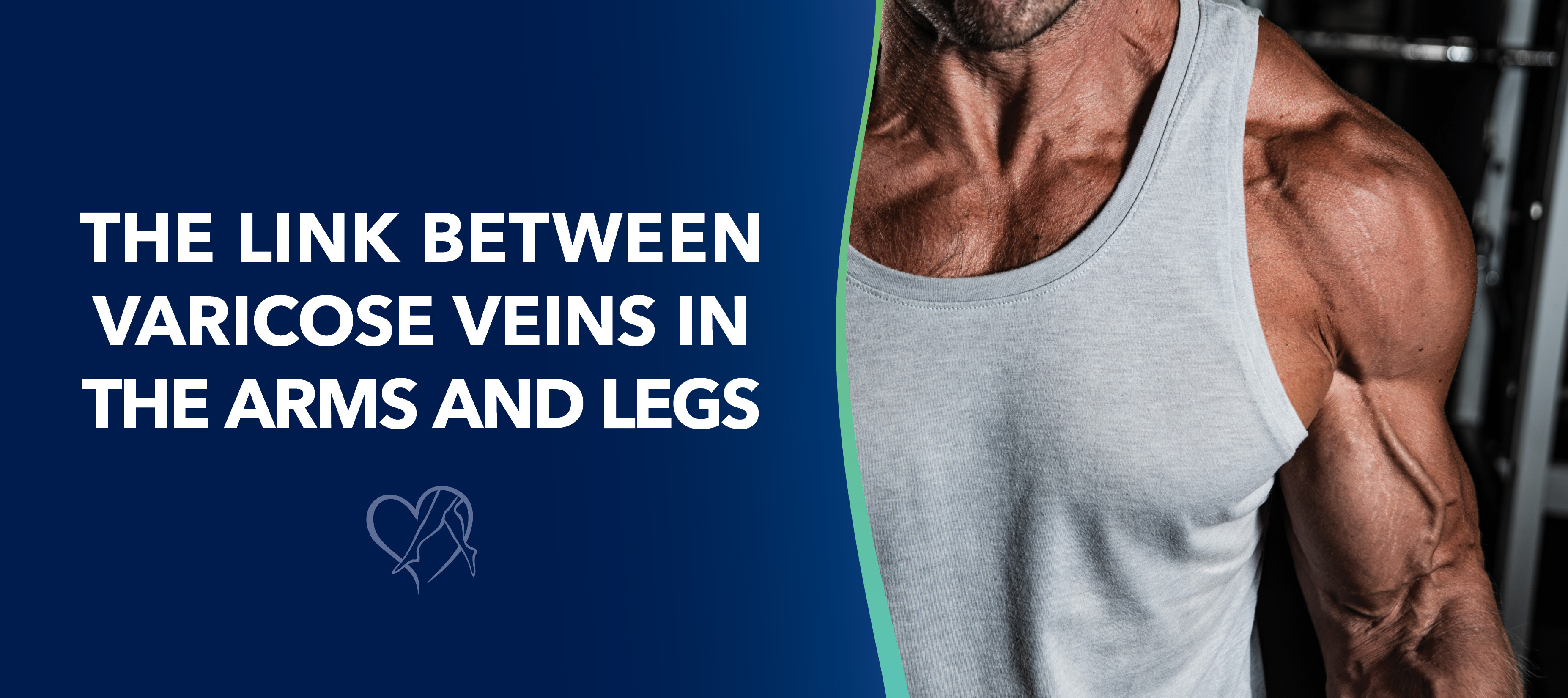 Blog Image Link Between Varicose Veins Arms And Legs