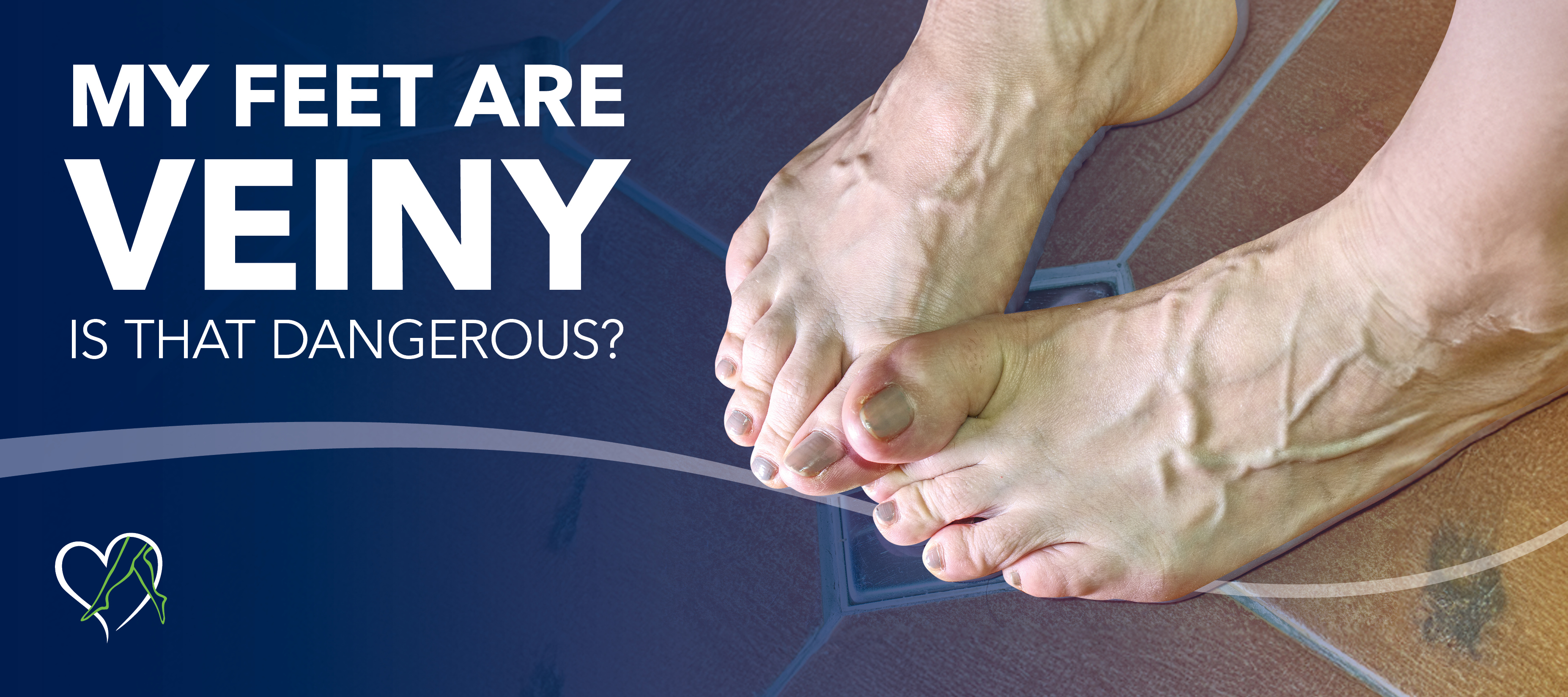Blog Image My Feet Are Veiny