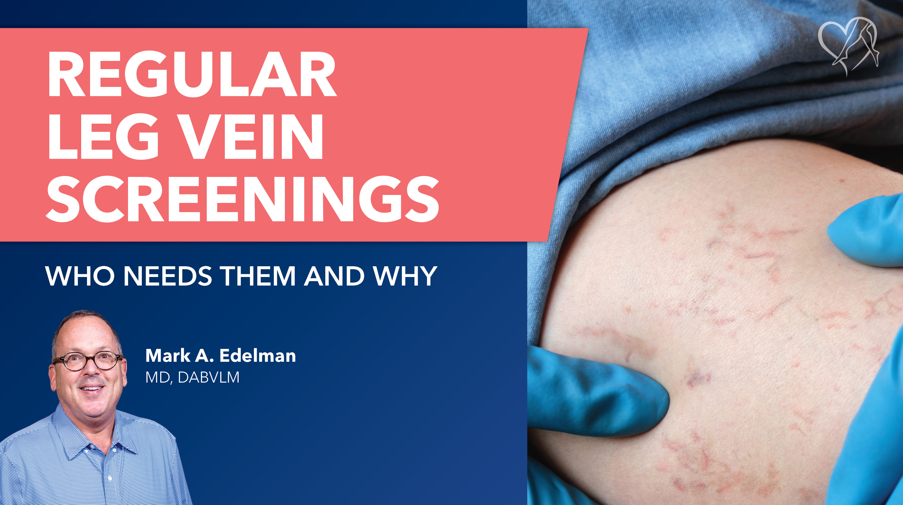 Blog Image Regular Vein Screenings Thunbnail REVISED