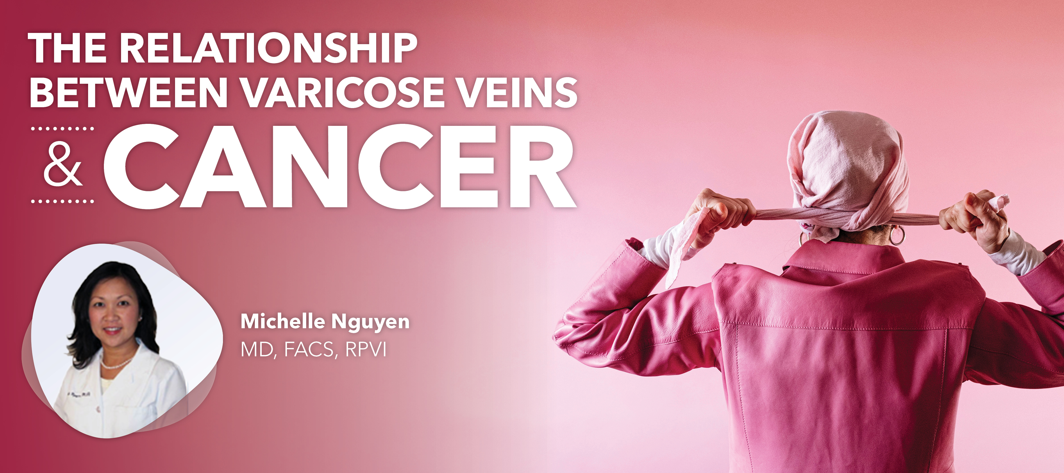 Blog Image Relationship Between Varicose Veins And Cancer