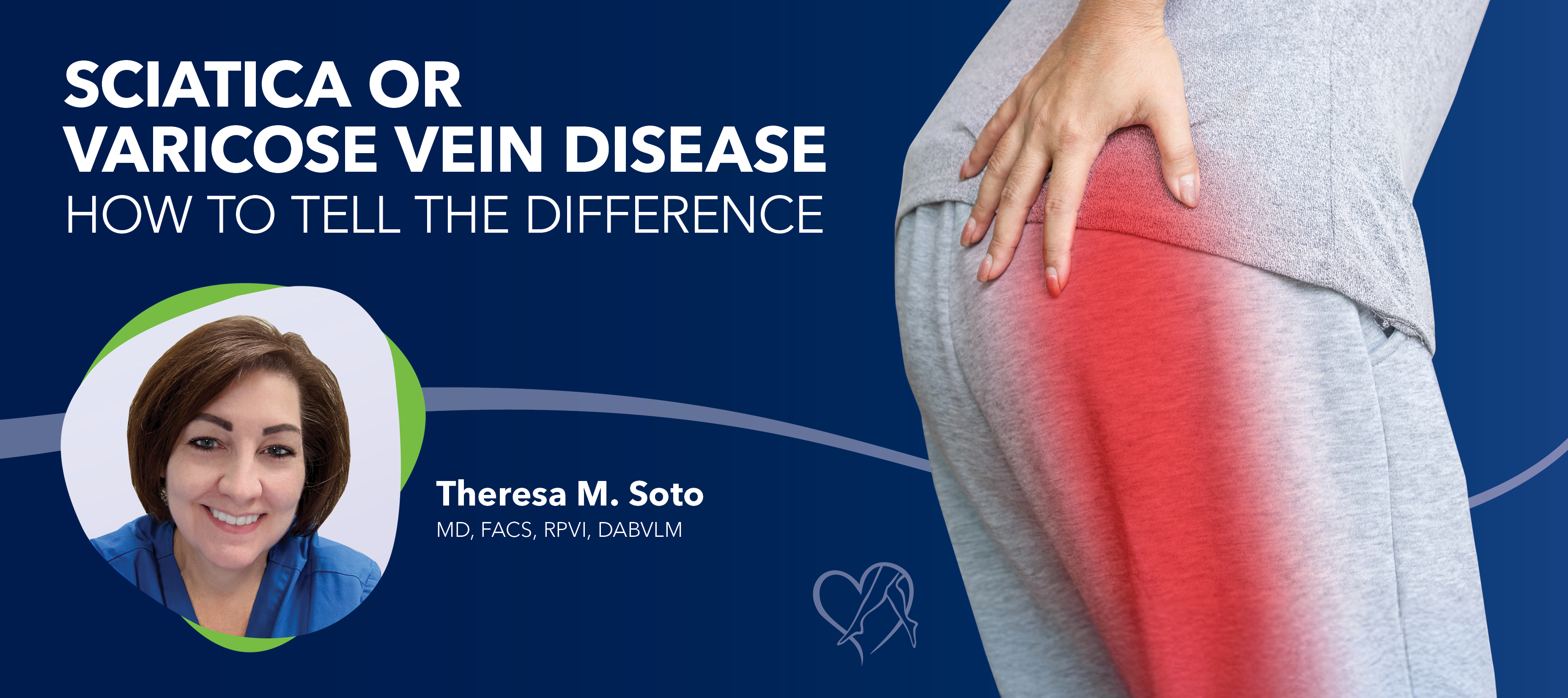 Blog Image Sciaticaor Varicose Vein Disease