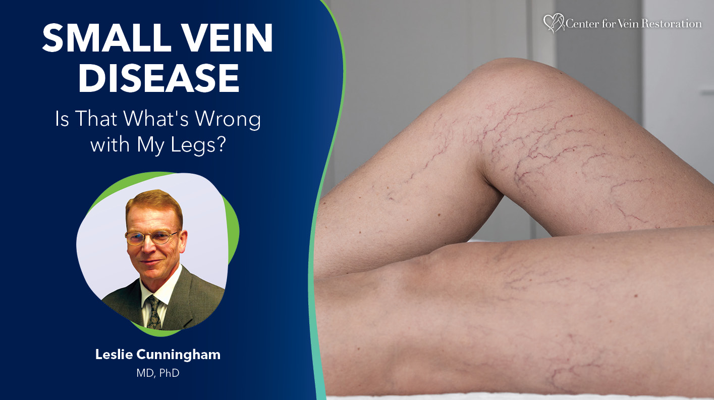Blog Image Small Vein Disease