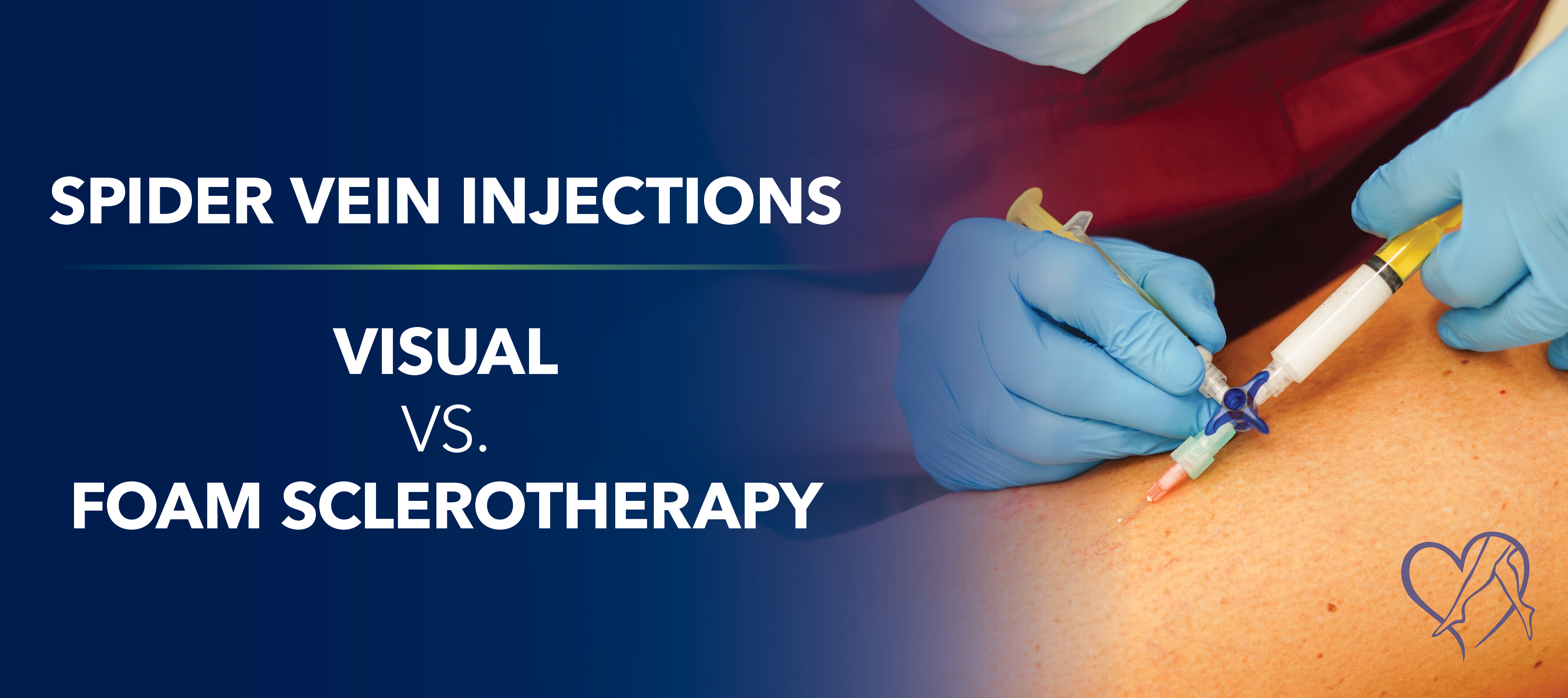 Blog Image Spider Vein Injections