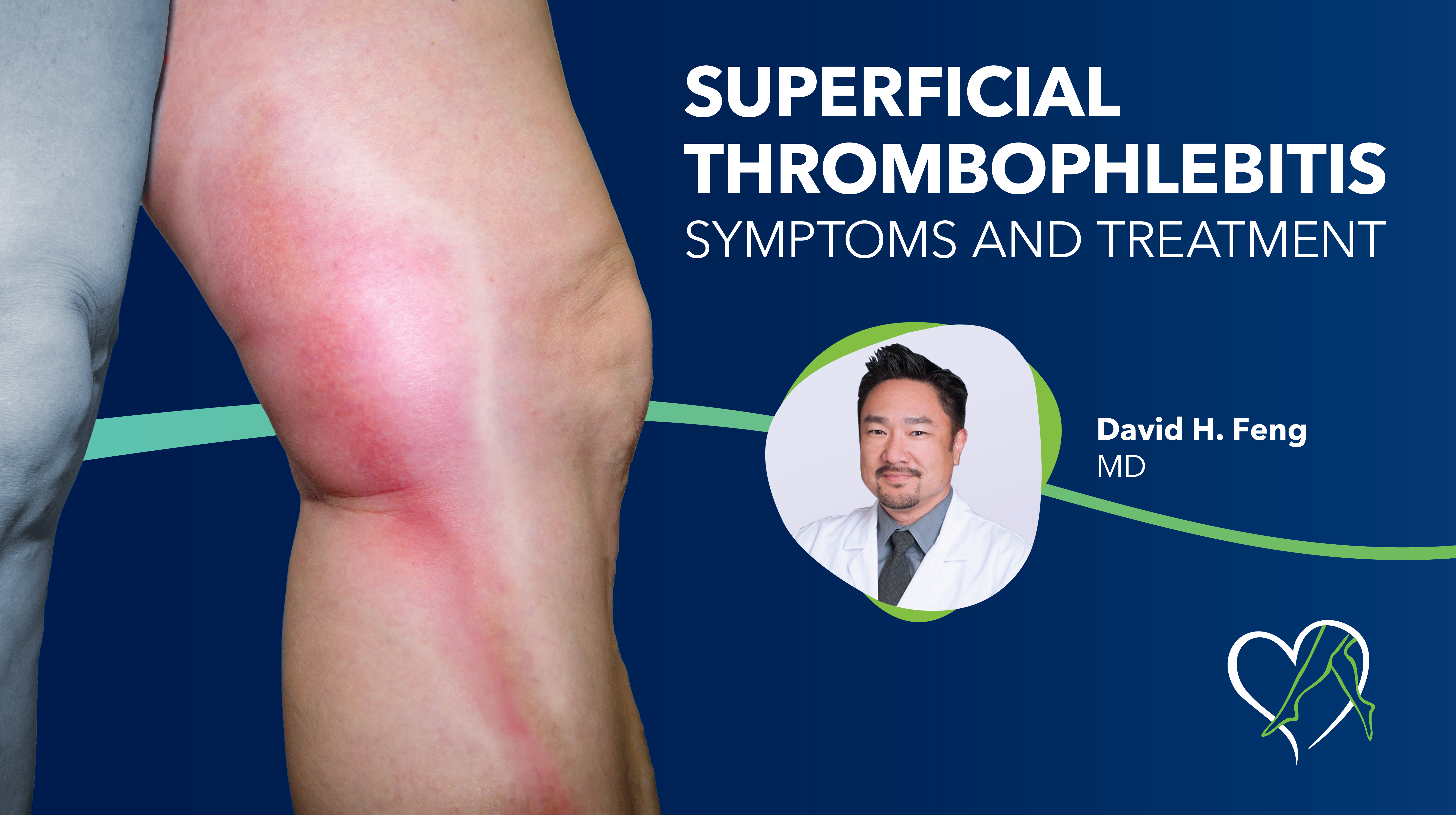 Blog Image Superficial Thrombophlebitis Thumbnail
