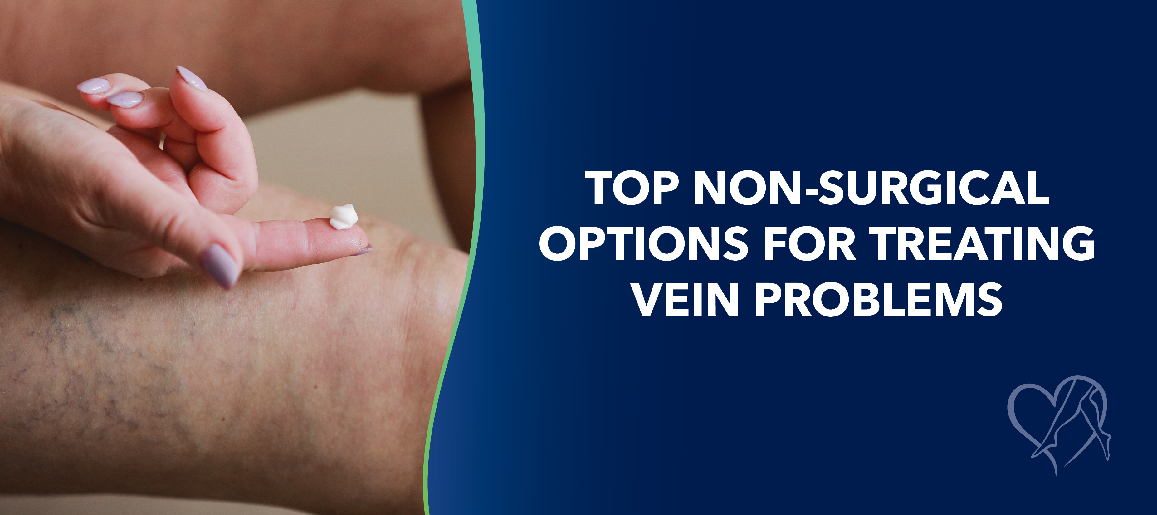 Blog Image Top Non Surgical Optionsfor Treating Vein Problems