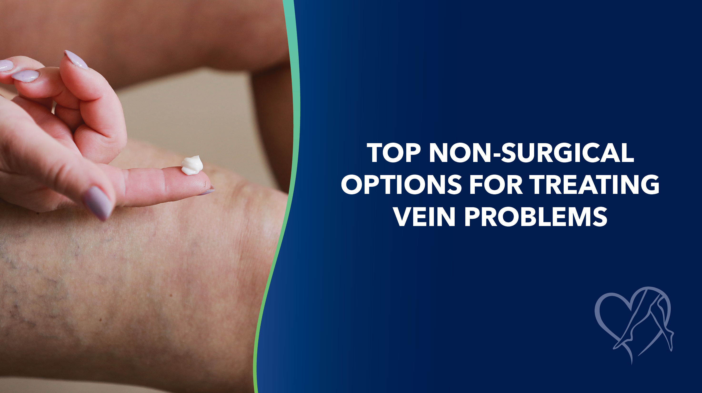 Blog Image Top Non Surgical Optionsfor Treating Vein Problems Thumbnail