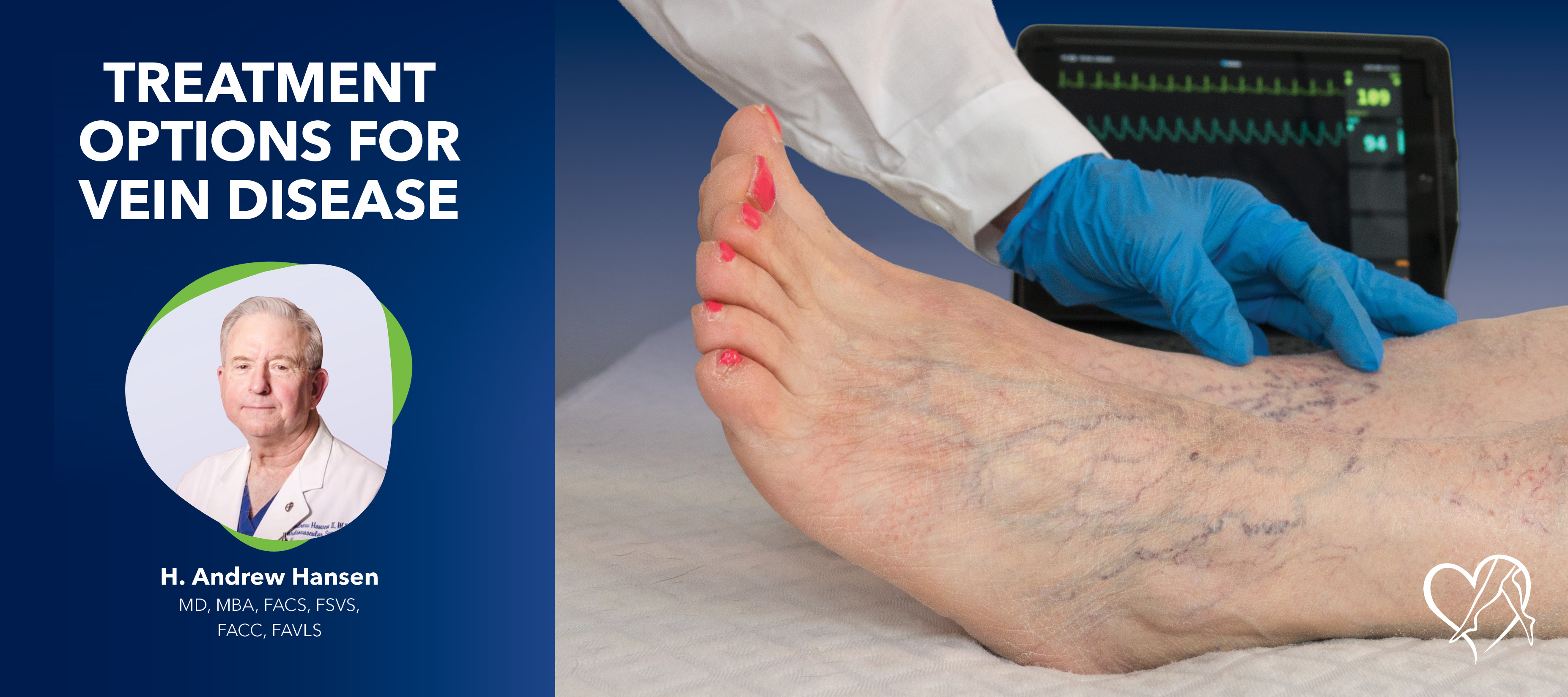 Blog Image Treatment Options For Vein Disease