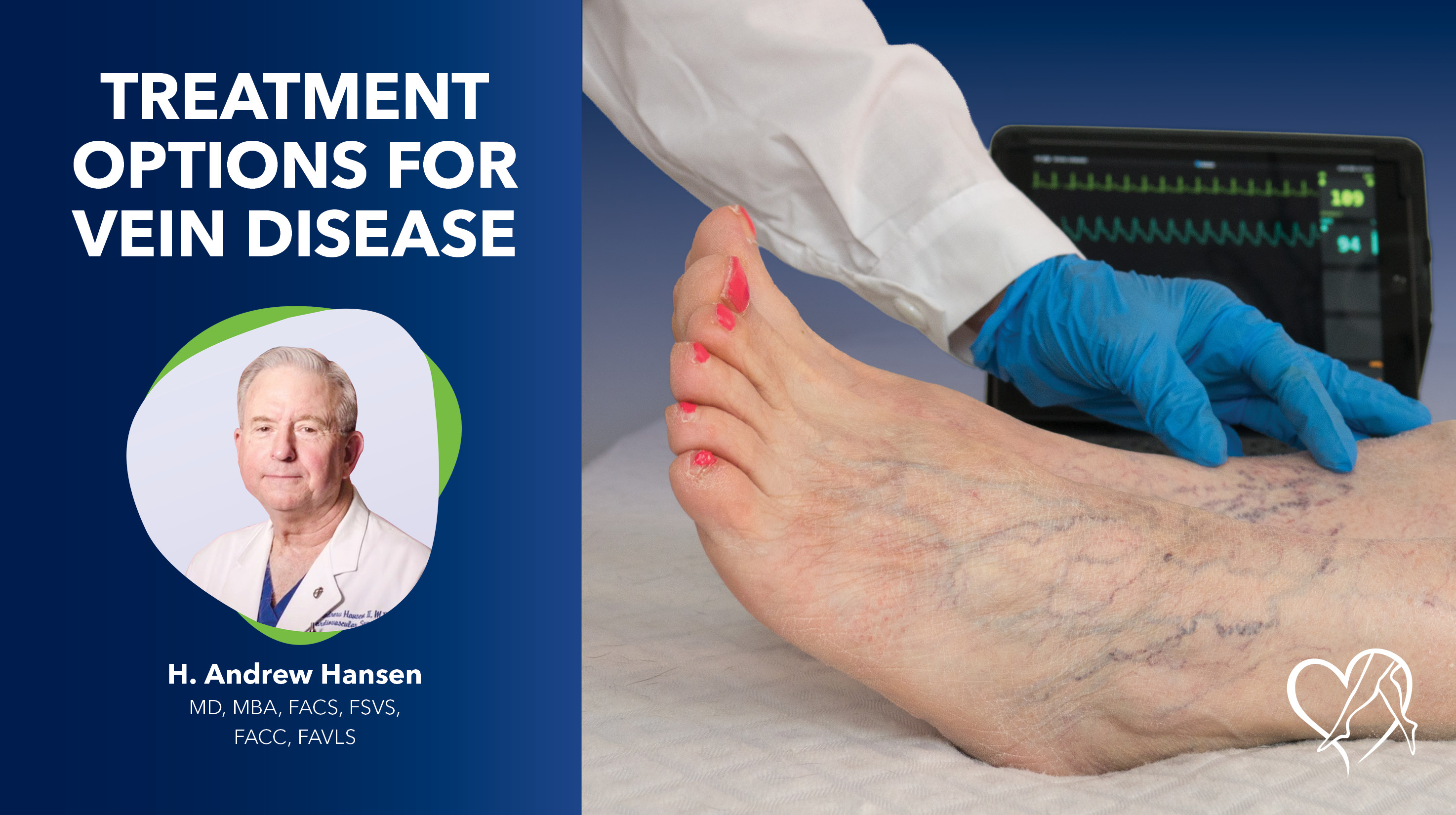 Blog Image Treatment Options For Vein Disease Thumbnail