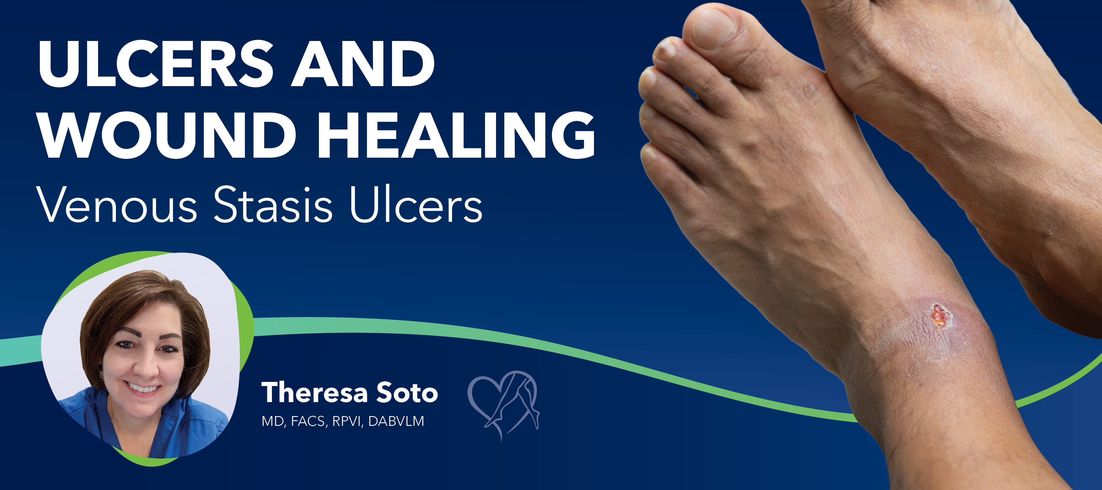 Center for Vein Restoration | lceras y Cicatrizacin de Heridas: lceras por Estasis Venosa Center for Vein Restoration | lceras y Cicatrizacin de Heridas: lceras por Estasis Venosa