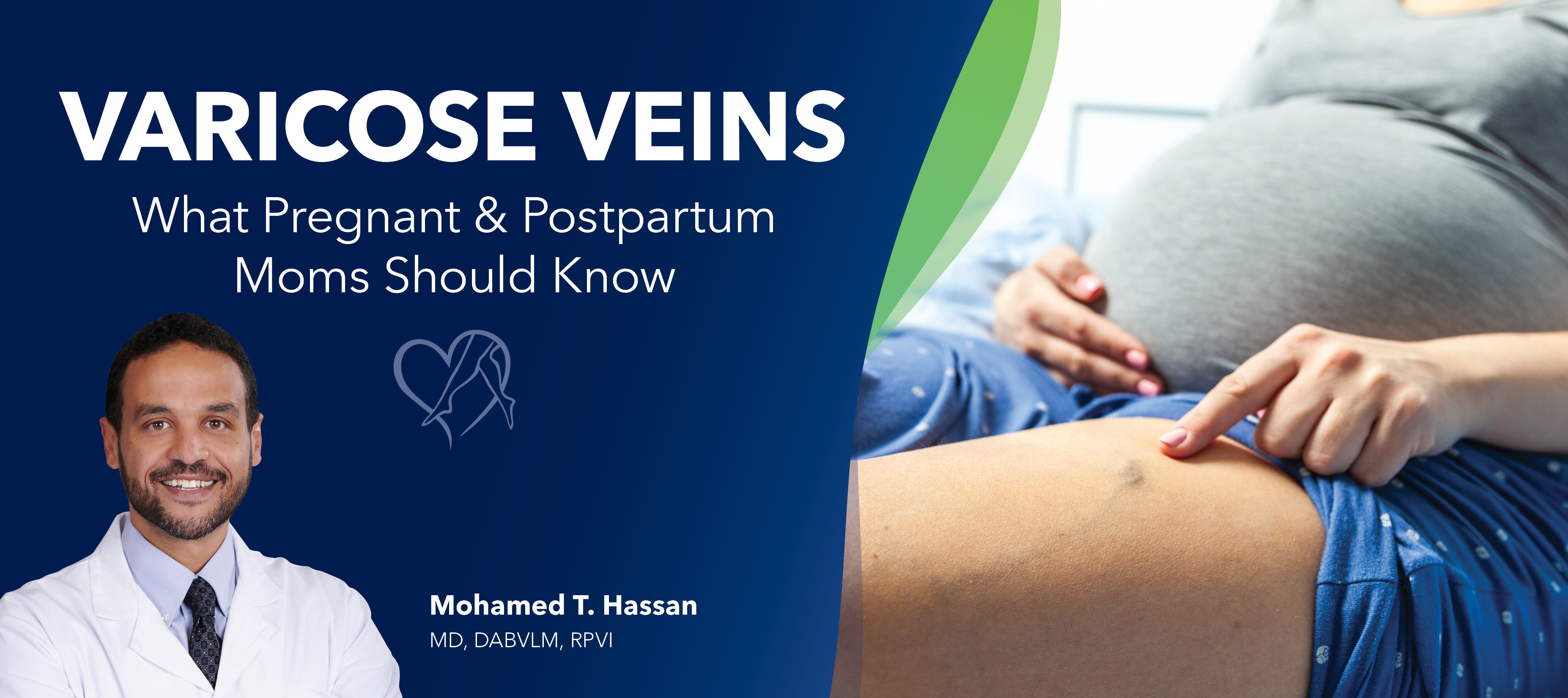 Blog Image Varicose Veins What Pregnant And Postpartum Moms Should Know
