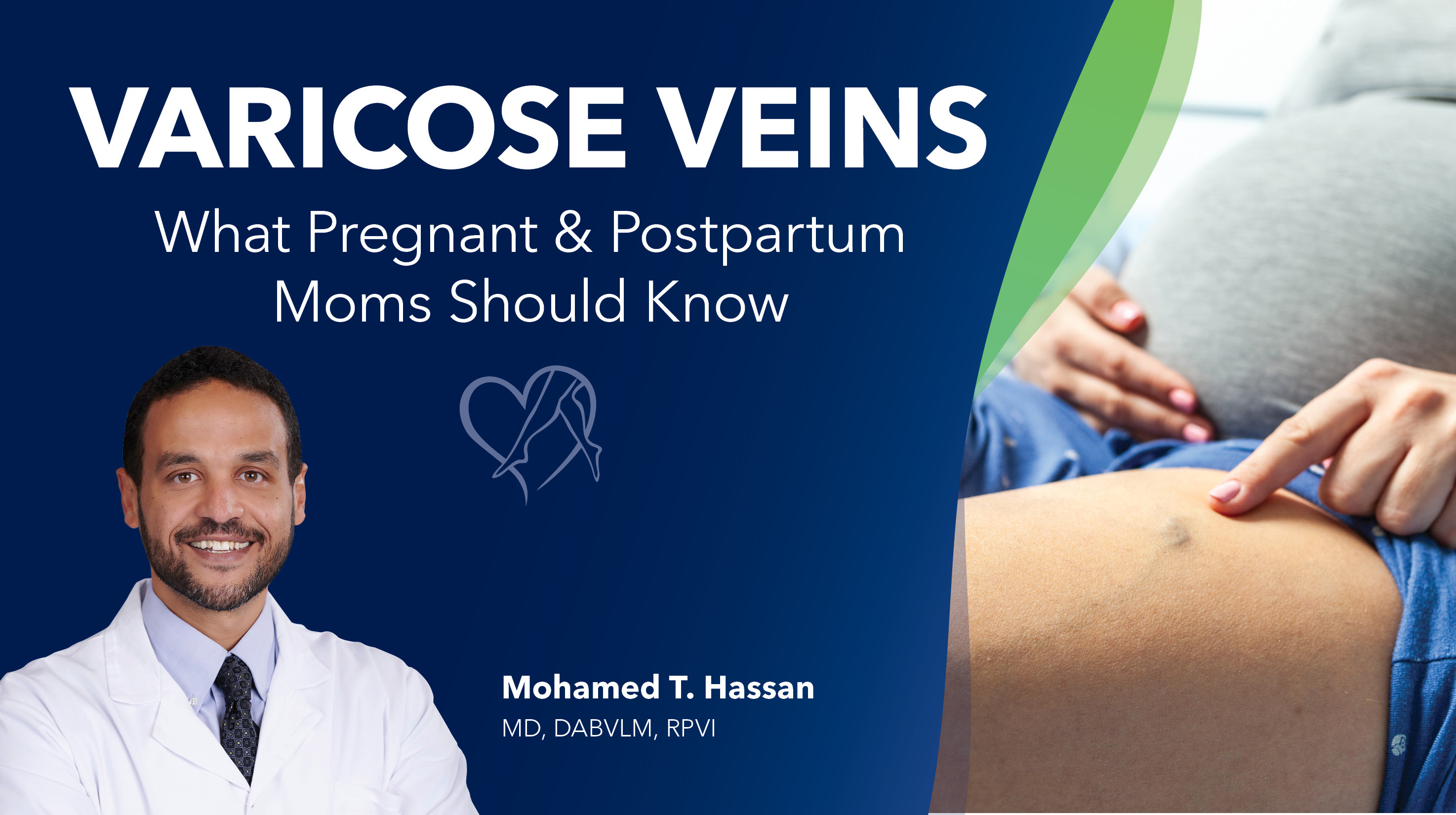 Blog Image Varicose Veins What Pregnant And Postpartum Moms Should Know Thumbnail