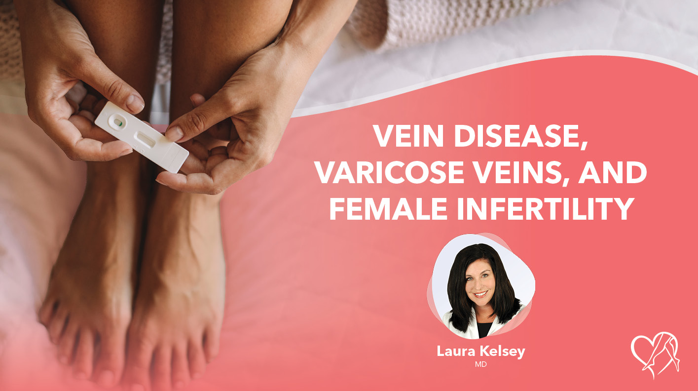 Blog Image Vein Disease Varicose Veins Female Infertility