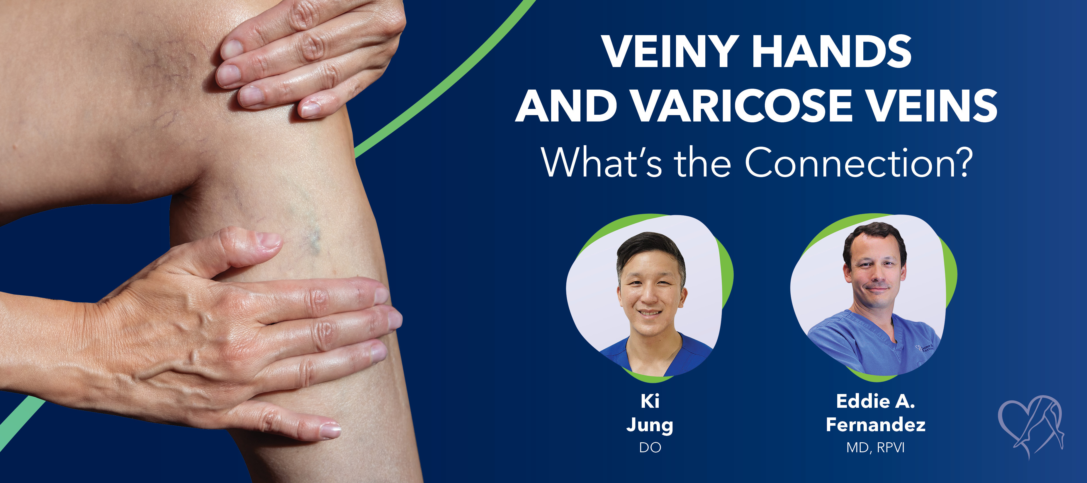 Veiny Hands and Varicose Veins: What’s the Connection?