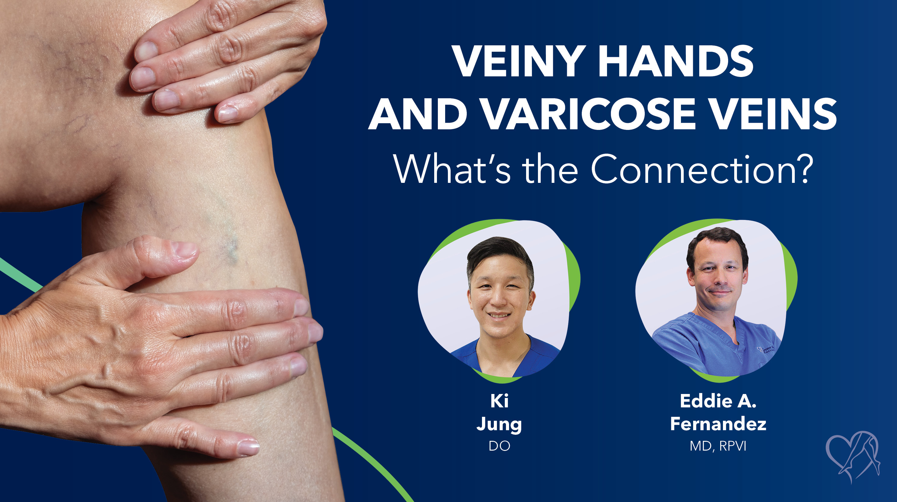 Blog Image Veiny Hands Thumbnail