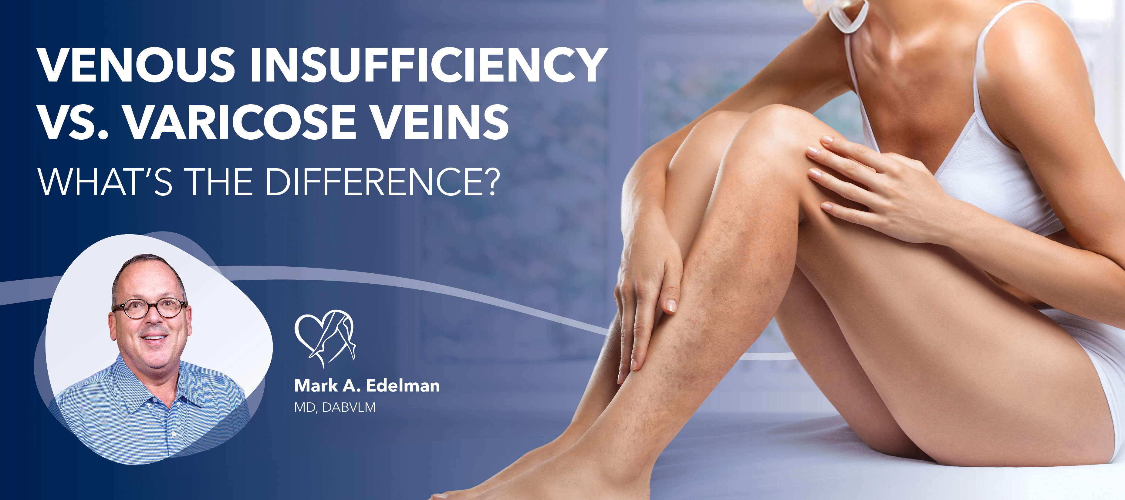Blog Image Venous Insufficiency Vs Varicose Veins