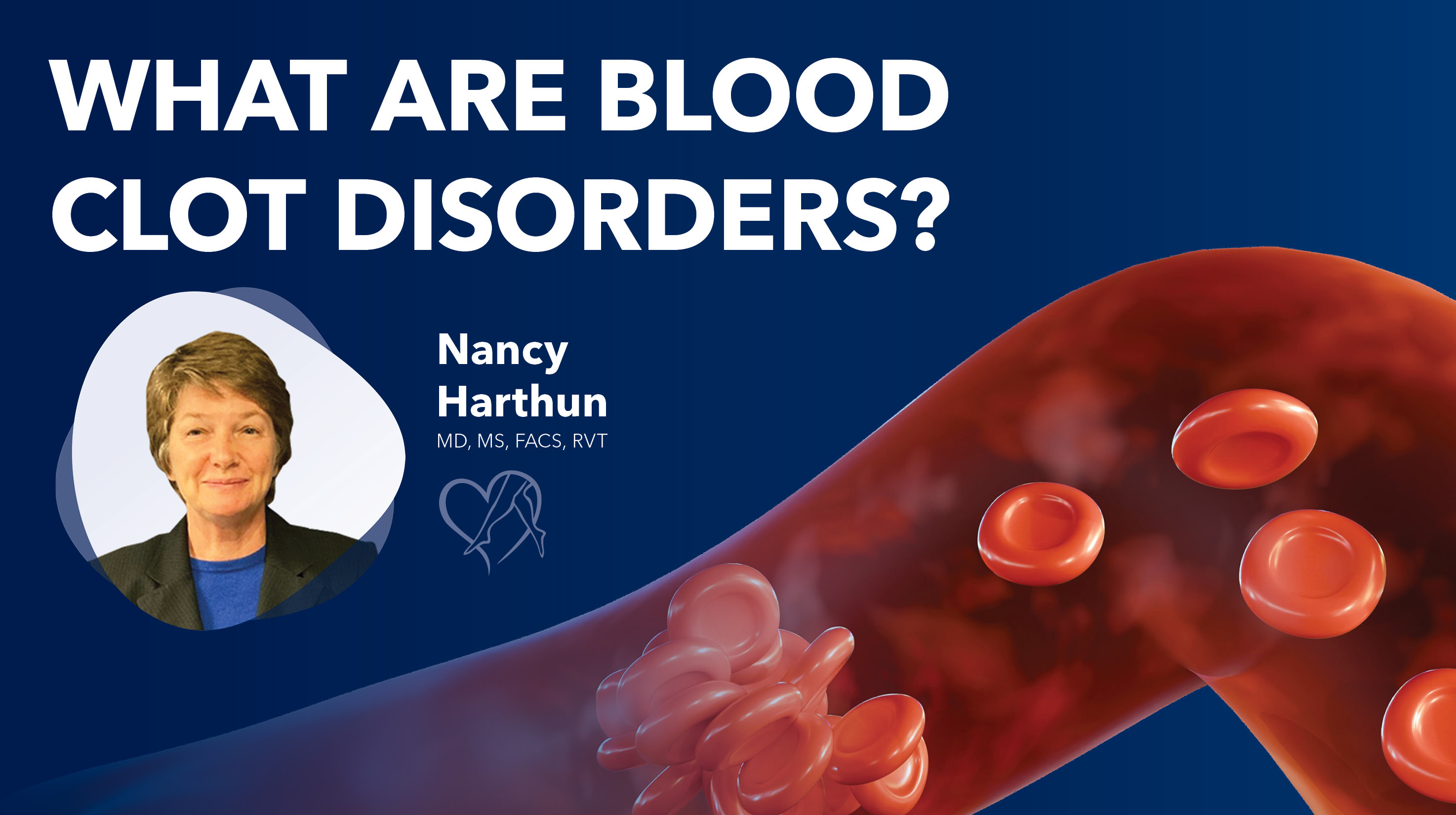 Blog Image What Are Blood Clot Disorders Thumbnail