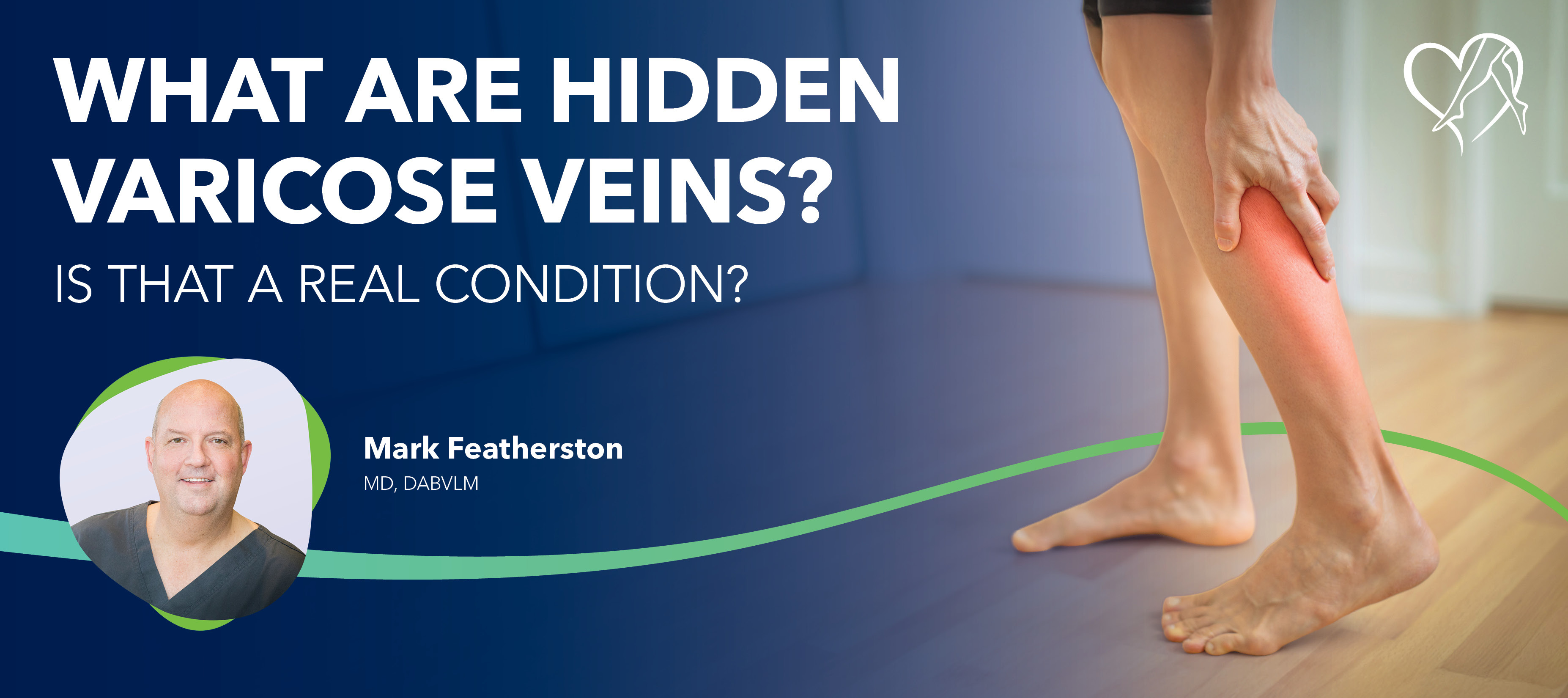 Blog Image What Are Hidden Varicose Veins