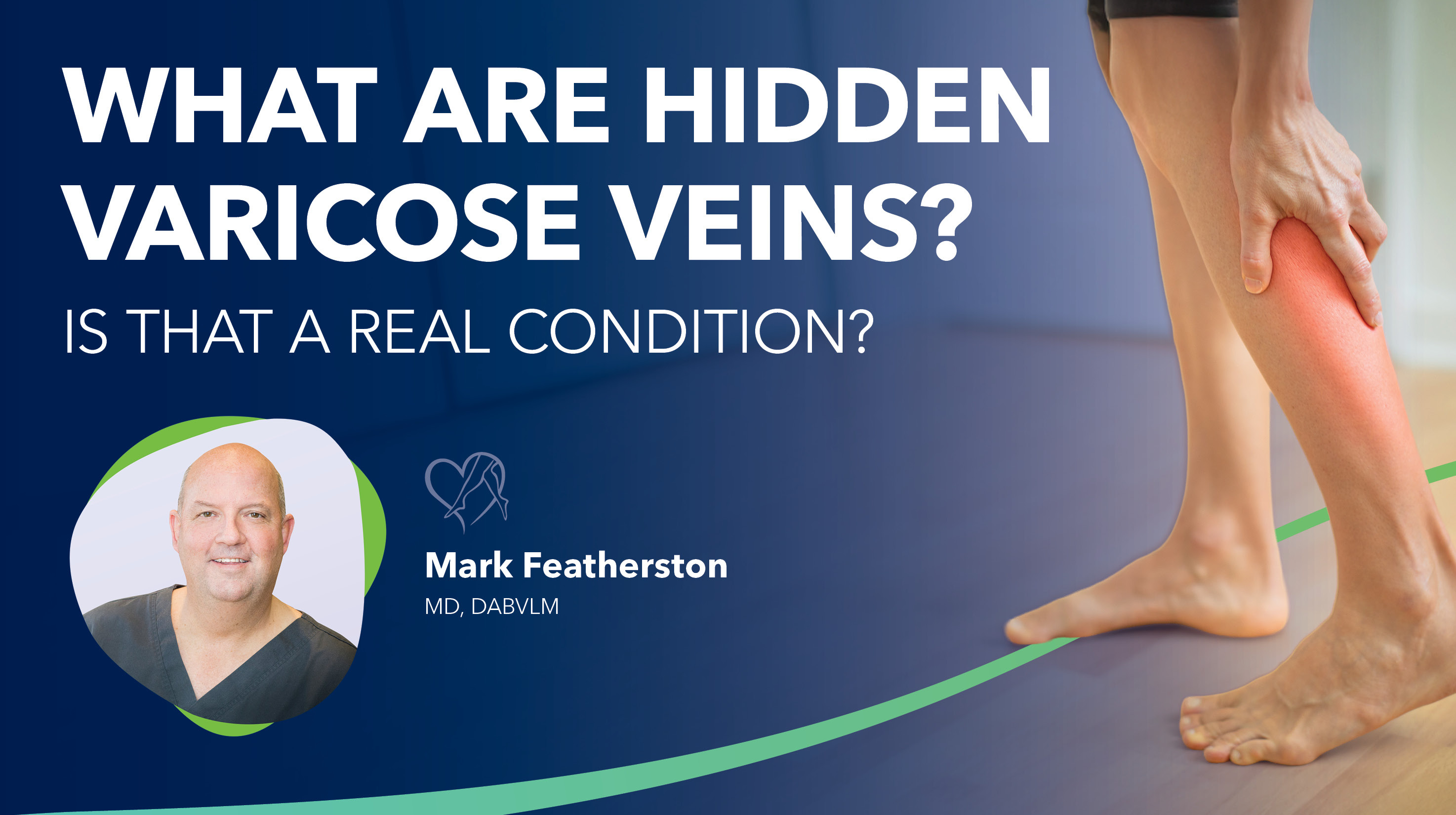 Blog Image What Are Hidden Varicose Veins Thumbnail