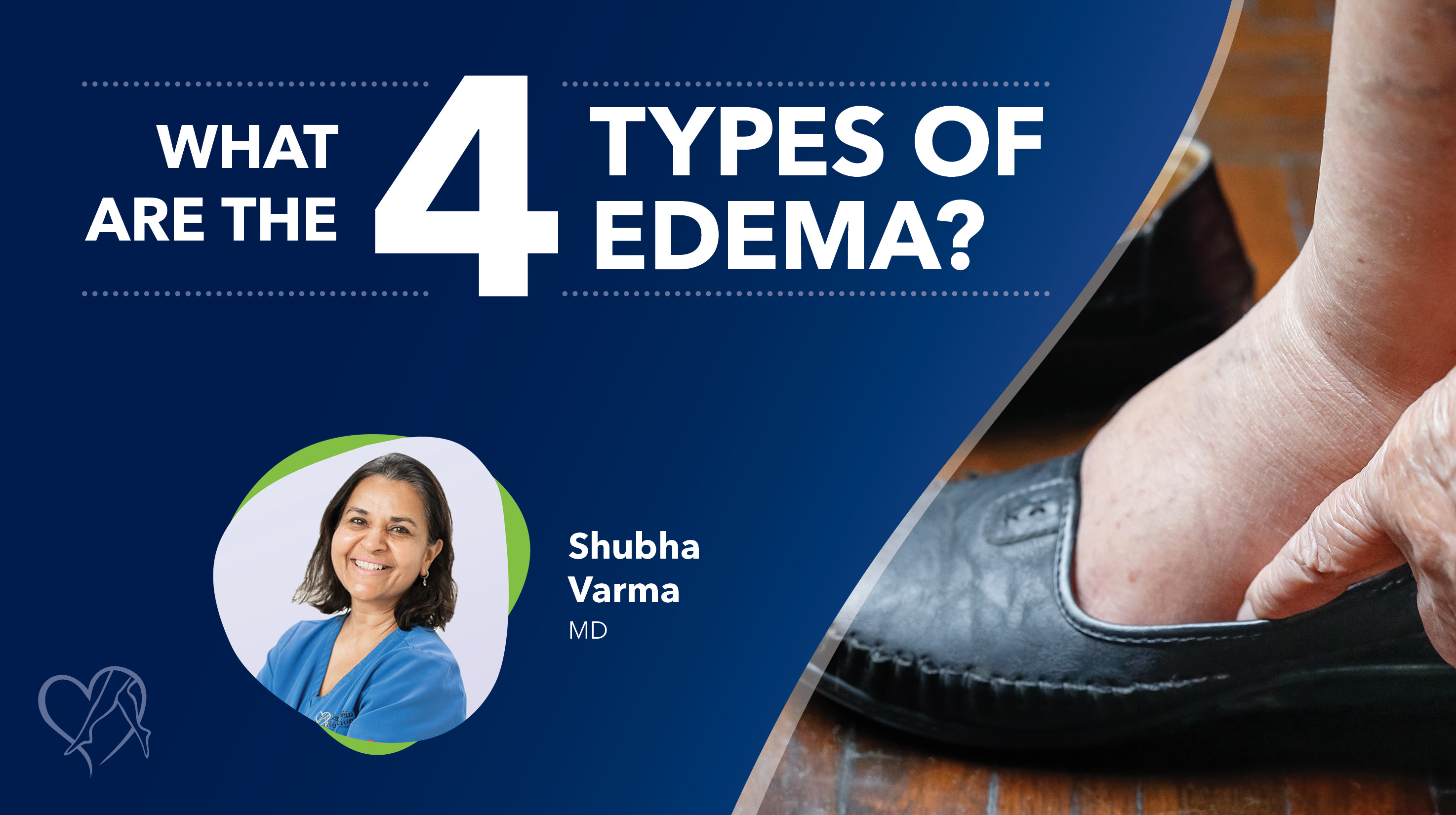 Blog Image What Are The Four Typesof Edema Thumbnail