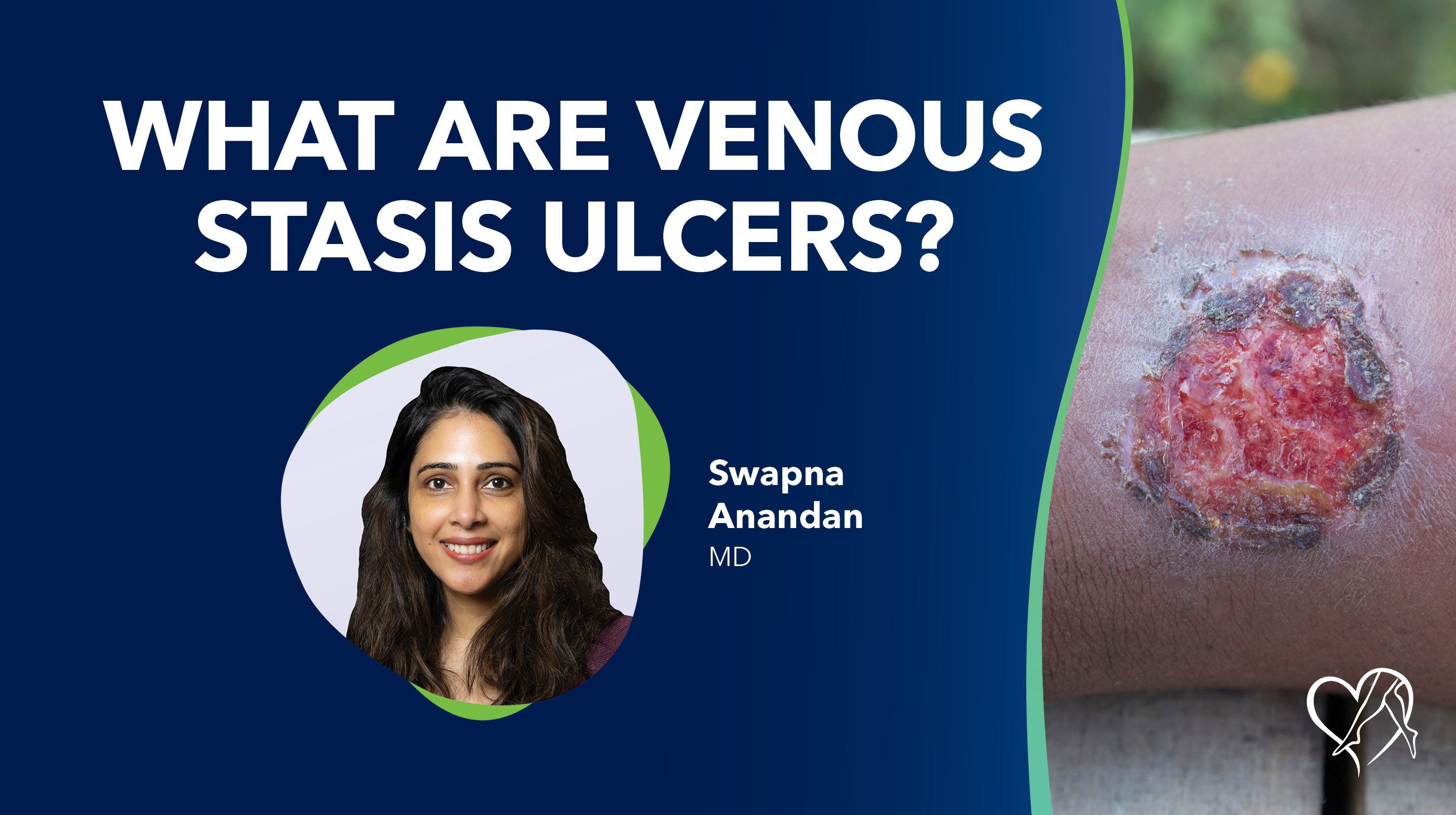 Blog Image What Are Venous Statis Ulcers Thumbnail