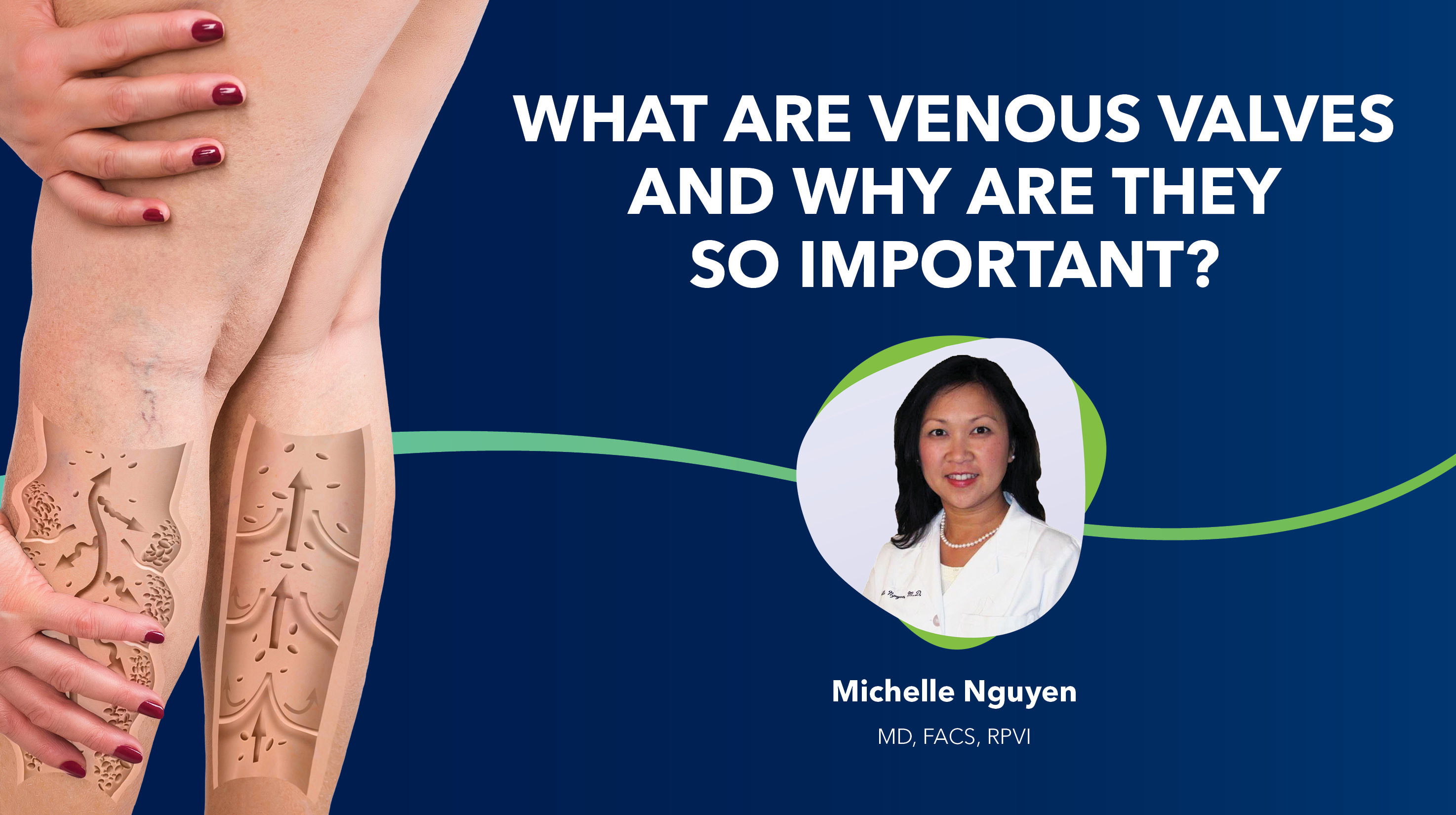 Blog Image What Are Venous Valves Thumbnail